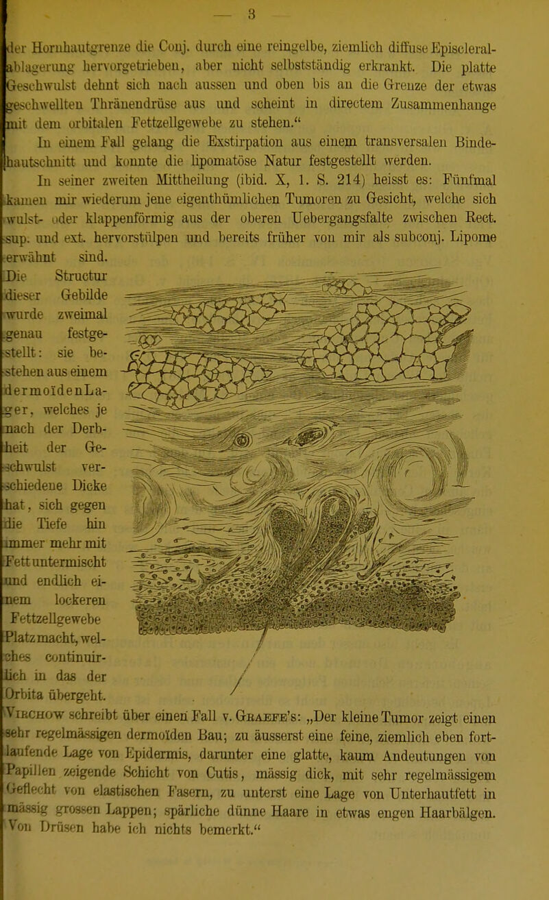 er Horuhautgrenze die Couj. durch eine reingelbe, ziemlich diffuse Episcleral- blagenmg her\orgetiiebeu, aber uicht selbstständig erkrankt. Die platte Geschwulst dehnt sich nach aussen und oben bis an die Grenze der etwas geschwellten Thränendrüse aus und scheint in directem Zusammenhange mit dem orbitalen Fettzellgewebe zu stehen. Iln einem Fall gelang die Exstirpation aus einem transversalen Binde- hautschnitt und konnte die lipomatöse Natur festgestellt werden. In seiner zweit^-n Mittheilung (ibid. X, 1. S. 214) heisst es: Fünfmal kamen mir wiederum jene eigenthümlichen Tumoren zu Gesicht, welche sich willst- oder klappenförmig aus der oberen Uebergangsfalte zwischen Rect. •sup. und ext hervorstülpen und bereits früher von mir als subconj. Lipome erwähnt sind. Die dieser wurde .genau Structur Gebüde zweimal festge- stellt : sie be- stehen aus einem dermoideuLa- ger, welches je jiach der Derb- heit der Ge- schwulst ver- schiedene Dicke hat, sich gegen die Tiefe hin mamer mehr mit Fett untermischt nnd endlich ei- gnem lockeren Fettzellgewebe Platz macht, wel- ches c^^utinuir- üch in das der Orbita übergeht, ^ViKCHOw schreibt über einen Fall v. Geaepe's: „Der kleine Tumor zeigt einen sehr regelmässigen dermolden Bau; zu äusserst eine feine, ziemlich eben fort- laufende Lage von P:pidermis, daimter eine glatte, kaum Andeutungen von Papillen zeigende Schicht von Cutis, mässig dick, mit sehr regelmässigem Geflecht von elastischen Fasern, zu uuterst eine Lage von Unterhautfett in mässig grossen Lappen; spärUche dünne Haare in etwas engen Haarbälgen. Von Drüsen habe ich nichts bemerkt. /