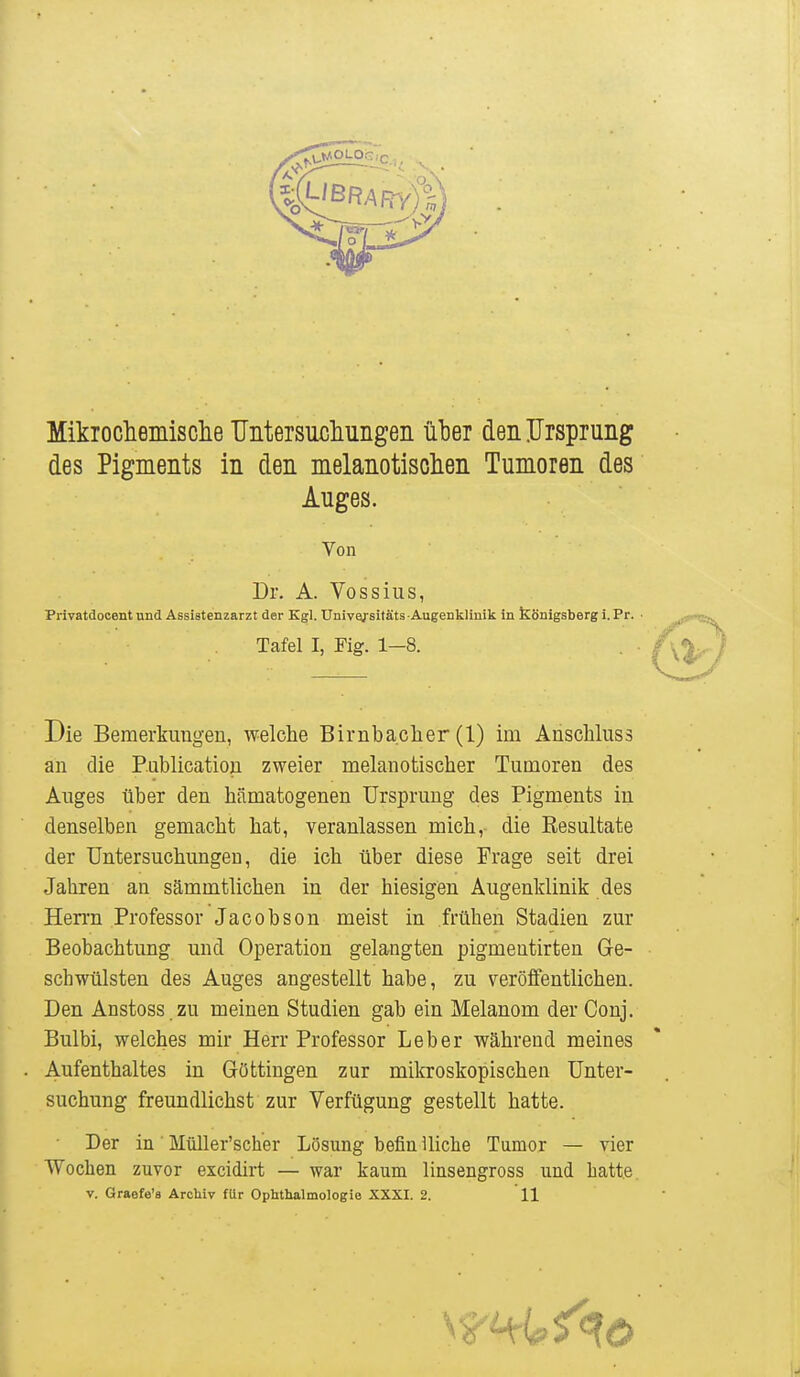 Mikrocliemisclie üntersucliuiigeii ii^er den Ursprung des Pigments in den melanotisolien Tumoren des Auges. Von Dr. A. Vossius, Privatdocent und Assiatenzarzt der Kgl. Univaj'sitäts Augenklinik in königsberg i. Pr. ■ Tafel I, Fig. 1-8. Die Bemerkungen, welche Birnbacher (1) im AnscMuss an die P.ublication zweier melanotischer Tumoren des Auges über den hämatogenen Ursprung des Pigments in denselben gemacht hat, veranlassen mich, die Resultate der Untersuchungen, die ich über diese Frage seit drei Jahren an sämmtlichen in der hiesigen Augenklinik des Hen-n Professor Jacobson meist in frühen Stadien zur Beobachtung und Operation gelangten pigmentirten Ge- schwülsten des Auges angestellt habe, zu veröffentlichen. Den Anstoss zu meinen Studien gab ein Melanom der Conj. Bulbi, welches mir Herr Professor Leber während meines Aufenthaltes in Göttingen zur milcroskopischen Unter- suchung freundlichst zur Verfügung gestellt hatte. Der in ■ Müller'scher Lösung befinUiche Tumor — vier Wochen zuvor excidirt — war kaum linsengross und hatt.e. V. Graefe'a ArcMv für Ophthalmologie XXXI. 2. 11