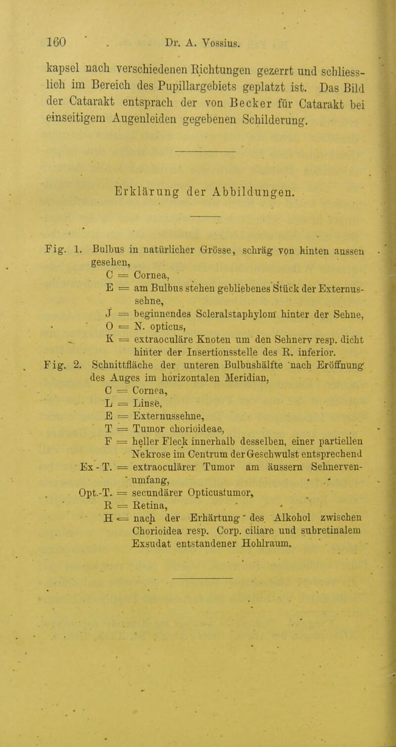 kapsei nach verschiedenen Richtungen geirrt und schliess- lich im Bereich des Pupillargebiets geplatzt ist. Das Bild der Catarakt entsprach der von Becker für Catarakt bei einseitigem Augeuleiden gegebenen Schilderung. Erklärung der Abbildungen. Fig. 1. Bulbus in natiirlicher Grösse, sclu-äg von hinten aussen gesehen, 0 = Cornea, E = am Bulbus stehen gebliebenes Stück der Externus- sehne, J = beginnendes Scleralstaphylom hinter der Sehne, 0 = N. opticus, K = extraoculäre Knoten um den Sehnerv resp. dicht hinter der Insertionsstelle des R. inferior. Fig. 2. Schnittfläche der unteren Bulbushälfte nach Eröffnung des Auges im horizontalen Meridian, C = Cornea, L = Linse, E = Externussehne, T = Tumor chorioideae, F = heller Fleck innerhalb desselben, einer partiellen Nekrose im Centrum der Geschwulst entsprechend Ex - T. = extraoculärer Tumor am äussern Sehnerven- ■ umfang, • . - Opt.-T. = secundärer Opticustumor, R = Eetina, H <= nach der Erhärtung' des. Alkohol zwischen Chorioidea resp. Corp. ciliare und subretinalem Exsudat entstandener Hohlraum.