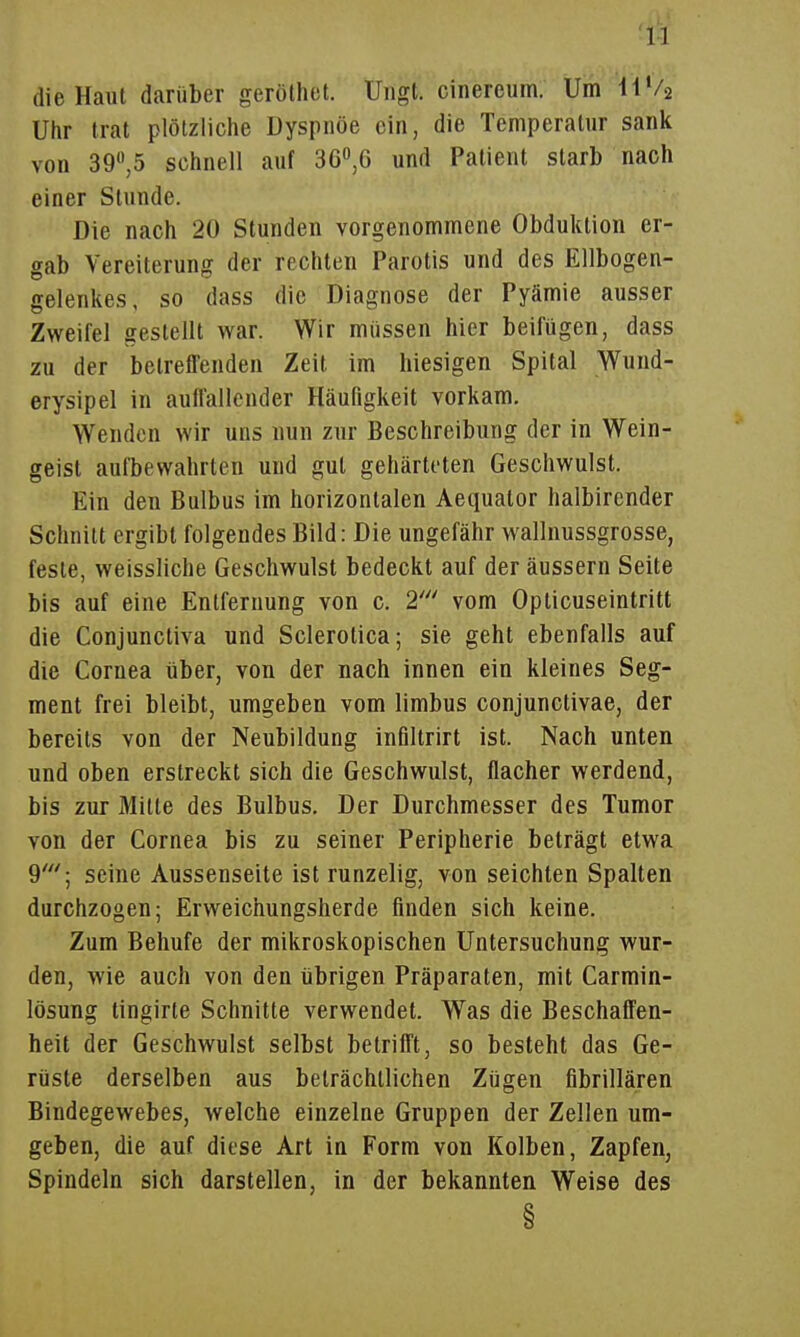 die Haut darüber geröthet. Uiigt. cinereum. Um llVa Uhr trat plötzliche Dyspnoe ein, die Temperatur sank von 39,5 schnell auf 3G0,G und Patient starb nach einer Stunde. Die nach 20 Stunden vorgenommene Obduktion er- gab Vereiterung der rechten Parotis und des Ellbogen- gelenkes, so dass die Diagnose der Pyämie ausser Zweifel gestellt war. Wir müssen hier beifügen, dass zu der betreffenden Zeit im hiesigen Spital Wund- erysipel in auffallender Häufigkeit vorkam. Wenden wir uns nun zur Beschreibung der in Wein- geist aulbewahrten und gut gehärteten Geschwulst. Ein den Bulbus im horizontalen Aequator halbirender Schnitt ergibt folgendes Bild: Die ungefähr wallnussgrosse, feste, weissliche Geschwulst bedeckt auf der äussern Seite bis auf eine Entfernung von c. 2' vom Opticuseintritt die ConjunctiA'a und Sclerotica; sie geht ebenfalls auf die Cornea über, von der nach innen ein kleines Seg- ment frei bleibt, umgeben vom limbus conjunctivae, der bereits von der Neubildung infiltrirt ist. Nach unten und oben erstreckt sich die Geschwulst, flacher werdend, bis zur Mitte des Bulbus. Der Durchmesser des Tumor von der Cornea bis zu seiner Peripherie beträgt etwa 9'; seine Aussenseite ist runzelig, von seichten Spalten durchzogen; Erweichungsherde finden sich keine. Zum Behufe der mikroskopischen Untersuchung wur- den, wie auch von den übrigen Präparaten, mit Carmin- lösung tingirte Schnitte verwendet. Was die Beschaffen- heit der Geschwulst selbst betrifft, so besteht das Ge- rüste derselben aus beträchtlichen Zügen fibrillären Bindegewebes, welche einzelne Gruppen der Zellen um- geben, die auf diese Art in Form von Kolben, Zapfen, Spindeln sich darstellen, in der bekannten Weise des §