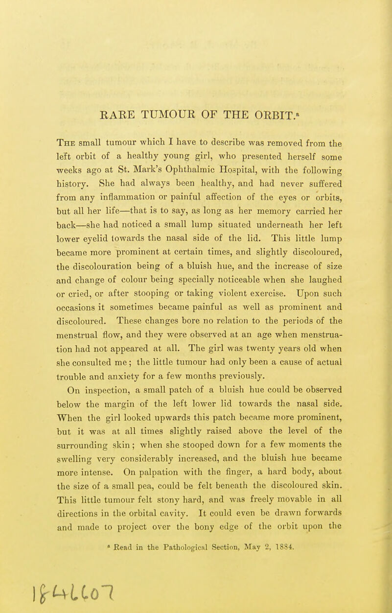 RAKE TUMOUR OF THE ORBIT.» The small tumour which I have to describe was removed from the left orbit of a healthy young girl, who presented herself some weeks ago at St. Mark's Ophthalmic Hospital, with the following history. She had always been healthy, and had never suffered from any inflammation or painful affection of the eyes or orbits, but all her life—that is to say, as long as her memory carried her back—she had noticed a small lump situated underneath her left lower eyelid towards the nasal side of the lid. This little lump became more prominent at certain times, and slightly discoloured, the discolouration being of a bluish hue, and the increase of size and change of colour being specially noticeable when she laughed or cried, or after stooping or taking violent exercise. Upon such occasions it sometimes became painful as well as prominent and discoloured. These changes bore no relation to the periods of the menstrual flow, and they were observed at an age when menstrua- tion had not appeared at all. The girl was twenty years old when she consulted me ; the little tumour had only been a cause of actual trouble and anxiety for a few months previously. On inspection, a small patch of a bluish hue could be observed below the margin of the left lower lid towards the nasal side. When the girl looked upwards this patch became more prominent, but it was at all times slightly raised above the level of the surrounding skin ; when she stooped down for a few moments the swelling very considerably increased, and the bluish hue became more intense. On palpation with the finger, a hard body, about the size of a small pea, could be felt beneath the discoloured skin. This little tumour felt stony hard, and was freely movable in all directions in the orbital cavity. It could even be drawn forwards and made to project over tlie bony edge of the orbit upon the » Read in the Pathological Section, May 2, 1884.