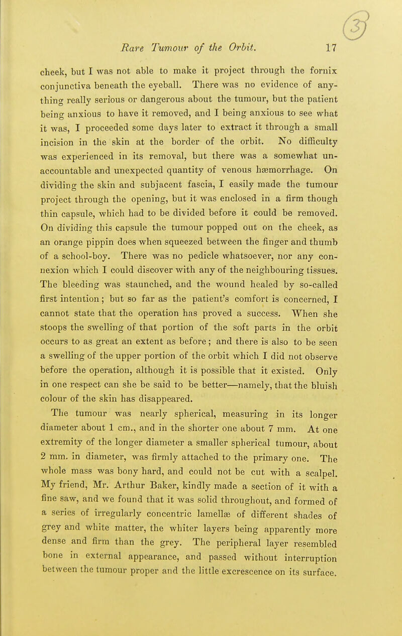 cheek, but I was not able to make it project through the fornix conjunctiva beneath the eyeball. There was no evidence of any- thing i-eally serious or dangerous about the tumour, but the patient being anxious to have it removed, and I being anxious to see what it was, I proceeded some days later to extract it through a small incision in the skin at the border of the orbit. No difficulty was experienced in its removal, but there was a somewhat un- accountable and unexpected quantity of venous haemorrhage. On dividing the skin and subjacent fascia, I easily made the tumour project through the opening, but it was enclosed in a firm though thin capsule, which had to be divided before it could be removed. On dividing this capsule the tumour popped out on the cheek, as an orange pippin does when squeezed between the finger and thumb of a school-boy. There was no pedicle whatsoever, nor any con- nexion vv'hich I could discover with any of the neighbouring tissues. The bleeding was staunched, and the wound healed by so-called first intention; but so far as the patient's comfort is concerned, I cannot state that the operation has proved a success. When she stoops the swelling of that portion of the soft parts in the orbit occurs to as great an extent as before; and there is also to be seen a swelling of the upper portion of the orbit which I did not observe before the operation, although it is possible that it existed. Only in one respect can she be said to be better—namely, that the bluish colour of the skin has disappeared. The tumour vras nearly spherical, measuring in its longer diameter about 1 cm., and in the shorter one about 7 mm. At one extremity of the longer diameter a smaller spherical tumour, about 2 mm. in diameter, was firmly attached to the primary one. The whole mass was bony hard, and could not be cut with a scalpel. My friend, Mr. Arthur Baker, kindly made a section of it with a fine saw, and we found that it was solid throughout, and formed of a series of irregularly concentric lamellae of different shades of grey and white matter, the whiter layers being apparently more dense and firm than the grey. The peripheral layer resembled bone in external appearance, and passed without interruption between the tumour proper and the little excrescence on its surface.