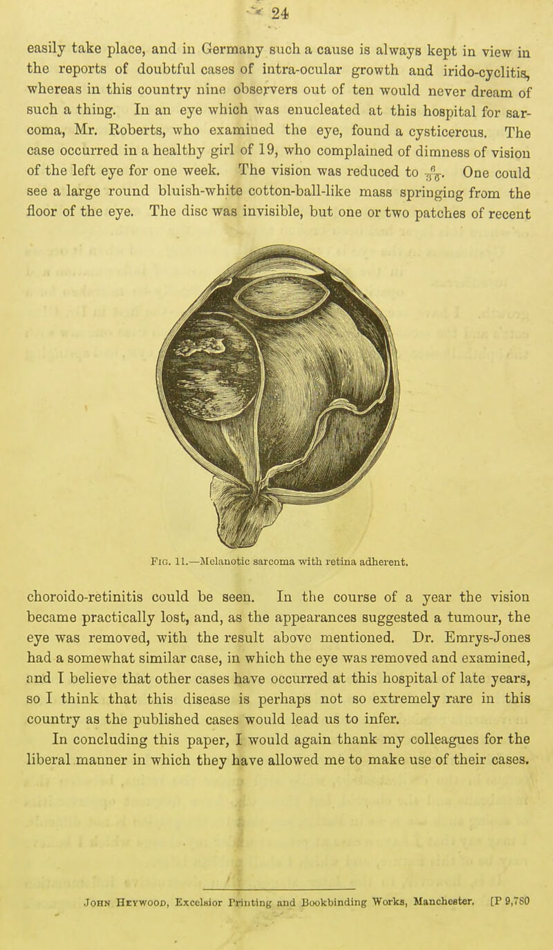 easily take place, and in Germany such a cause is always kept in view in the reports of doubtful cases of intra-ocular growth and irido-cyclitis, whereas in this country nine observers out of ten would never dream of such a thing. In an eye which was enucleated at this hospital for sar- coma, Mr. Eoberts, who examined the eye, found a cysticercus. The case occurred in a healthy girl of 19, who complained of dimness of vision of the left eye for one week. The vision was reduced to Jr. One could see a large round bluish-white cotton-ball-like mass springing from the floor of the eye. The disc was invisible, but one or two patches of recent Fio. 11.—Melanotic sarcoma with retina adherent. choroido-retinitis could be seen. In the course of a year the vision became practically lost, and, as the appearances suggested a tumour, the eye was removed, with the result above mentioned. Dr. Emrys-Jones had a somewhat similar case, in which the eye was removed and examined, and I believe that other cases have occurred at this hospital of late years, so I think that this disease is perhaps not so extremely rare in this country as the published cases would lead us to infer. In concluding this paper, I would again thank my colleagues for the liberal manner in which they have allowed me to make use of their cases. John Heywood, Excelsior Printing and Bookbinding Works, Manchester. [r 9,7S0