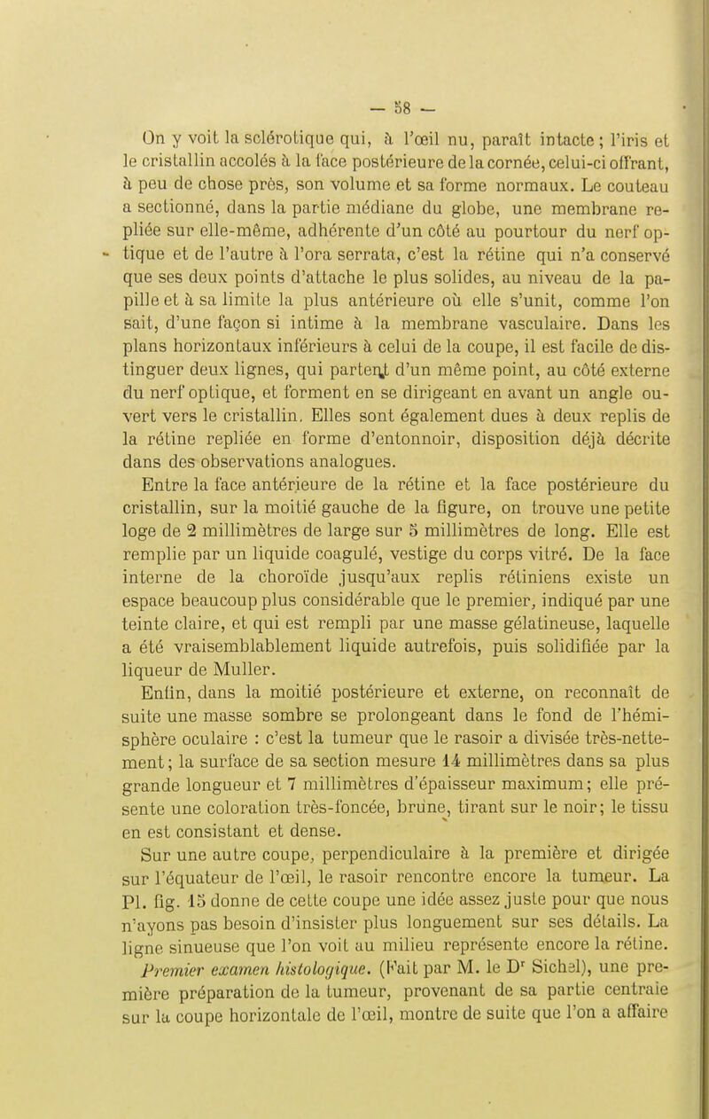 On y voit la sclérotique qui, à l'œil nu, paraît intacte ; l'iris et le cristallin accolés à la face postérieure de la cornée, celui-ci offrant, h peu de chose près, son volume et sa forme normaux. Le couteau a sectionné, dans la partie médiane du globe, une membrane re- pliée sur elle-même, adhérente d'un côté au pourtour du nerf op- - tique et de l'autre à l'ora serrata, c'est la rétine qui n'a conservé que ses deux points d'attache le plus solides, au niveau de la pa- pille et à sa limite la plus antérieure où elle s'unit, comme l'on sait, d'une façon si intime à la membrane vasculaire. Dans les plans horizontaux inférieurs à celui de la coupe, il est facile de dis- tinguer deux lignes, qui parteii,t d'un même point, au côté externe du nerf optique, et forment en se dirigeant en avant un angle ou- vert vers le cristallin. Elles sont également dues à deux replis de la rétine repliée en forme d'entonnoir, disposition déjà décrite dans des observations analogues. Entre la face antérieure de la rétine et la face postérieure du cristallin, sur la moitié gauche de la figure, on trouve une petite loge de 2 millimètres de large sur 5 millimètres de long. Elle est remplie par un liquide coagulé, vestige du corps vitré. De la face interne de la choroïde jusqu'aux replis rétiniens existe un espace beaucoup plus considérable que le premier, indiqué par une teinte claire, et qui est rempli par une masse gélatineuse, laquelle a été vraisemblablement liquide autrefois, puis solidifiée par la liqueur de Muller. Enfin, dans la moitié postérieure et externe, on reconnaît de suite une masse sombre se prolongeant dans le fond de l'hémi- sphère oculaire : c'est la tumeur que le rasoir a divisée très-nette- ment ; la surface de sa section mesure lA millimètres dans sa plus grande longueur et 7 millimètres d'épaisseur maximum; elle pré- sente une coloration très-foncée, brune, tirant sur le noir; le tissu en est consistant et dense. Sur une autre coupe, perpendiculaire à la première et dirigée sur l'équateur de l'œil, le rasoir rencontre encore la tumeur. La Pl. fig. 15 donne de celte coupe une idée assez juste pour que nous n'ayons pas besoin d'insister plus longuement sur ses détails. La ligne sinueuse que l'on voit au milieu représente encore la rétine. Premier examen histologique. (Fait par M. le D'^ Sichsl), une pre- mière préparation de la tumeur, provenant de sa partie centrale sur la coupe horizontale de l'œil, montre de suite que l'on a affaire