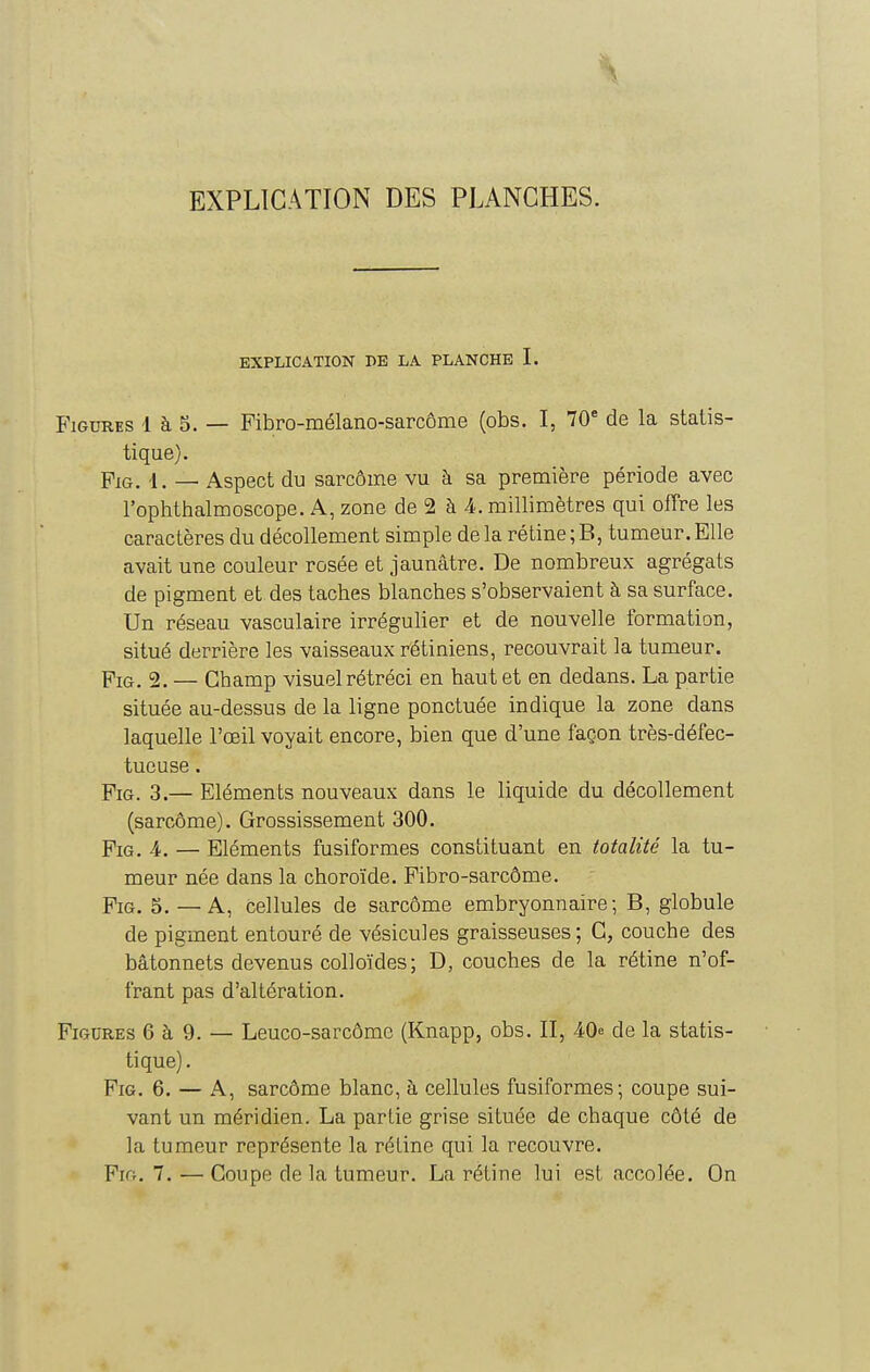 EXPLICATION DES PLANCHES. EXPLICATION I>E LA PLANCHE I. Figures 1 à 5. — Fibro-mélano-sarcôme (obs. I, 70* de la statis- tique). FxG. 1. — Aspect du sarcôme vu à sa première période avec l'ophthalmoscope. A, zone de 2 à 4. millimètres qui offre les caractères du décollement simple de la rétine ; B, tumeur. Elle avait une couleur rosée et jaunâtre. De nombreux agrégats de pigment et des taches blanches s'observaient à sa surface. Un réseau vasculaire irrégulier et de nouvelle formation, situé derrière les vaisseaux rétiniens, recouvrait la tumeur. FiG. 2. — Champ visuel rétréci en haut et en dedans. La partie située au-dessus de la ligne ponctuée indique la zone dans laquelle l'œil voyait encore, bien que d'une façon très-défec- tueuse . FiG. 3.— Eléments nouveaux dans le liquide du décollement (sarcôme). Grossissement 300. FiG. 4. — Eléments fusiformes constituant en totalité la tu- meur née dans la choroïde. Fibro-sarcôme. FiG. 5. — A, cellules de sarcôme embryonnaire; B, globule de pigment entouré de vésicules graisseuses; C, couche des bâtonnets devenus colloïdes; D, couches de la rétine n'of- frant pas d'altération. Figures 6 à 9. — Leuco-sarcôme (Knapp, obs. II, 40 de la statis- tique). FiG. 6. — A, sarcôme blanc, à cellules fusiformes; coupe sui- vant un méridien. La partie grise située de chaque côté de la tumeur représente la rétine qui la recouvre. Pir;. 7. — Coupe de la tumeur. La rétine lui est accolée. On