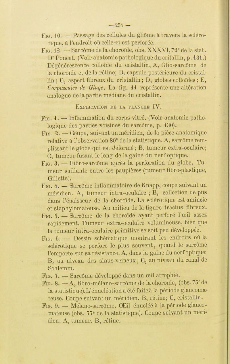 PiG. 10. — Passage des cellules du gliôme h travers la scléro- tique, à l'endroit oii celle-ci est perforée. FiG. 12. — Sarcome de la choroïde, obs. XXXVI, 72^ de la slat. D Poucet. (Voir anatomie pathologique du critallin, p. 131.) Dégénérescence colloïde du cristallin, A, G]io-sarcome de la choroïde et de la réline; B, capsule postérieure du cristal- lin ; C, aspect fibreux du cristallin ; D, globes colloïdes ; E, Corpuscules de Gluge. La fîg. 11 représente une altération analogue de la partie médiane du cristallin. Explication de la planche IV. FiG. 1. — Inflammation du corps vitré. (Voir anatomie patho- logique des parties voisines du sarcome, p. 130). FiG. 2. — Coupe, suivant un méridien, de la pièce anatomique relative à l'observation 80* de la statistique. A, sarcome rem- plissant le globe qui est déformé; B, tumeur extra-oculaire; C, tumeur fusant le long de ia gaîne du nerf optique. FiG. 3. — Fibro-sarcôme après la perforation du globe. Tu- meur saillante entre les paupières (tumeur fibro-plastique, Gillette). Pi0. 4,. _ Sarcome inflammatoire de Knapp, coupe suivant un méridien. A, tumeur intra-oculaire ; B, collection de pus dans l'épaisseur de la choroïde. La sclérotique est amincie et staphylomateuse. Au milieu de la figure tractus fibreux. FiG. 5. — Sarcome de la choroïde ajant perforé l'œil assez rapidement. Tumeur extra-oculaire volumineuse, bien que la tumeur intra-oculaire primitive se soit peu développée. PxG. 6. — Dessin schématique montrant les endroits où la sclérotique se perfore le plus souvent, quand le sarcome l'emporte sur sa résistance. A, dans la gaine du nerf optique; B, au niveau des sinus veineux; G, au niveau du canal de Schlemm. FiG. 7. — Sarcome développé dans un œil atrophié. FiG. 8. — A, fîbro-mélano-sarcôme de la choroïde, (obs. 75 de la statistique).L'énucIéationaété faiteàla période glaucoma- teuse. Coupe suivant un méridien. B, rétine; C, cristallin. FiG. 9. — Mélano-sarcôme. OEil énucléé à la période glauco- mateuse (obs. 77° de la statistique). Coupe suivant un méri- dien. A, tumeur. B, rétine.