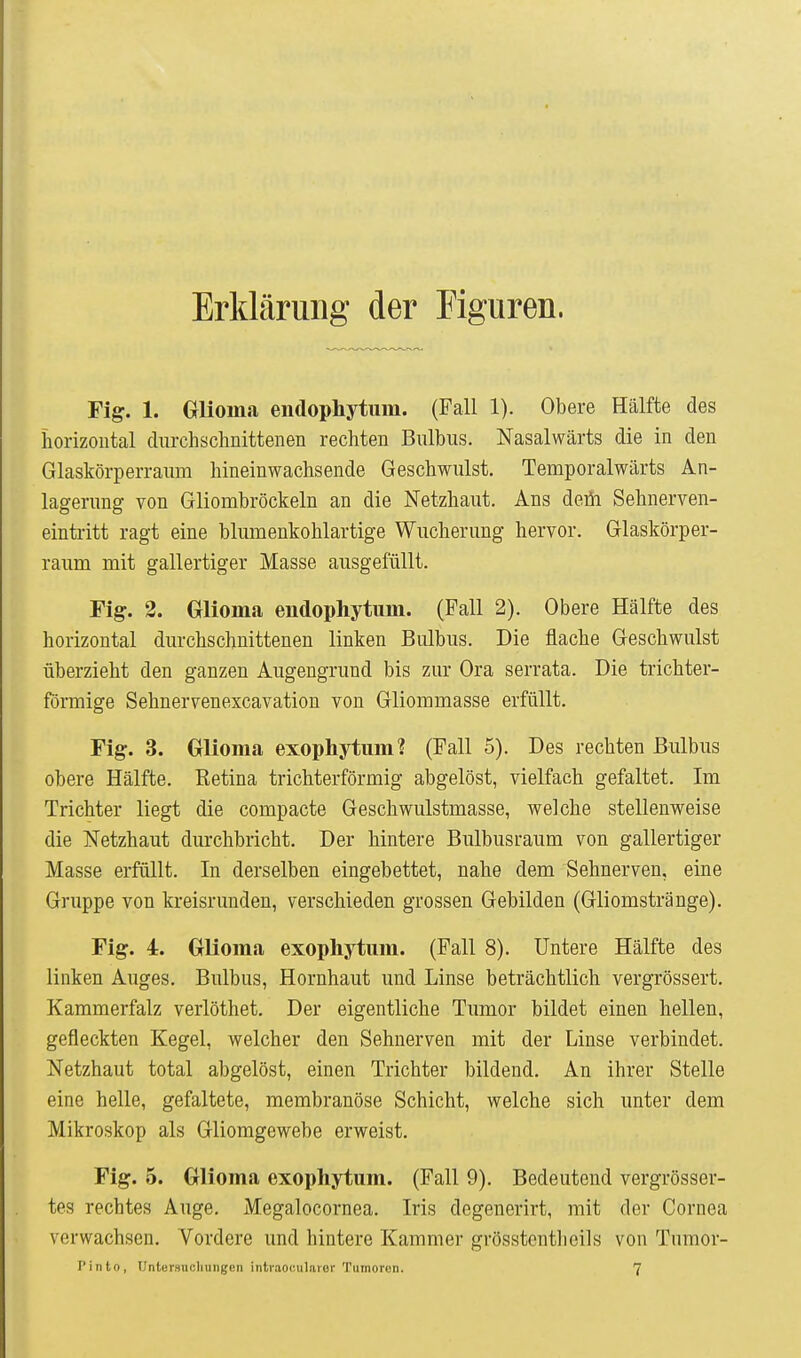 Erklärung der Figuren. Fig. 1. Glioma endophytum. (Fall 1). Obere Hälfte des horizontal durchschnittenen rechten Bulbus. Nasalwärts die in den Glaskörperraum hineinwachsende Geschwulst. Temporalwärts An- lagerung von Gliombröckeln an die Netzhaut. Ans deüi Sehnerven- eintritt ragt eine blumenkohlartige Wucherung hervor. Glaskörper- raum mit gallertiger Masse ausgefüllt. Fig. 2. Glioma endophytum. (Fall 2). Obere Hälfte des horizontal durchschnittenen linken Bulbus. Die flache Geschwulst überzieht den ganzen Augengrund bis zur Ora serrata. Die trichter- förmige Sehnervenexcavation von Gliommasse erfüllt. Fig. 3. Glioma exophytum? (Fall 5). Des rechten Bulbus obere Hälfte. Retina trichterförmig abgelöst, vielfach gefaltet. Im Trichter liegt die compacte Geschwulstmasse, welche stellenweise die Netzhaut durchbricht. Der hintere Bulbusraum von gallertiger Masse erfüllt. In derselben eingebettet, nahe dem Sehnerven, eine Gruppe von kreisrunden, verschieden grossen Gebilden (Gliomstränge). Fig. 4. Glioma exophytum. (Fall 8). Untere Hälfte des linken Auges. Bulbus, Hornhaut und Linse beträchtlich vergrössert. Kammerfalz verlöthet. Der eigentliche Tumor bildet einen hellen, gefleckten Kegel, welcher den Sehnerven mit der Linse verbindet. Netzhaut total abgelöst, einen Trichter bildend. An ihrer Stelle eine helle, gefaltete, membranöse Schicht, welche sich unter dem Mikroskop als Gliomgewebe erweist. Fig. 5. Glioma exophytum. (Fall 9). Bedeutend vergrösser- tes rechtes Auge. Megalocornea. Iris degenerirt, mit der Cornea verwachsen. Vordere und hintere Kammer grösstentlieils von Tumor- J'into, TJntersucliungen iiitiaoculnior Tumoren. 7