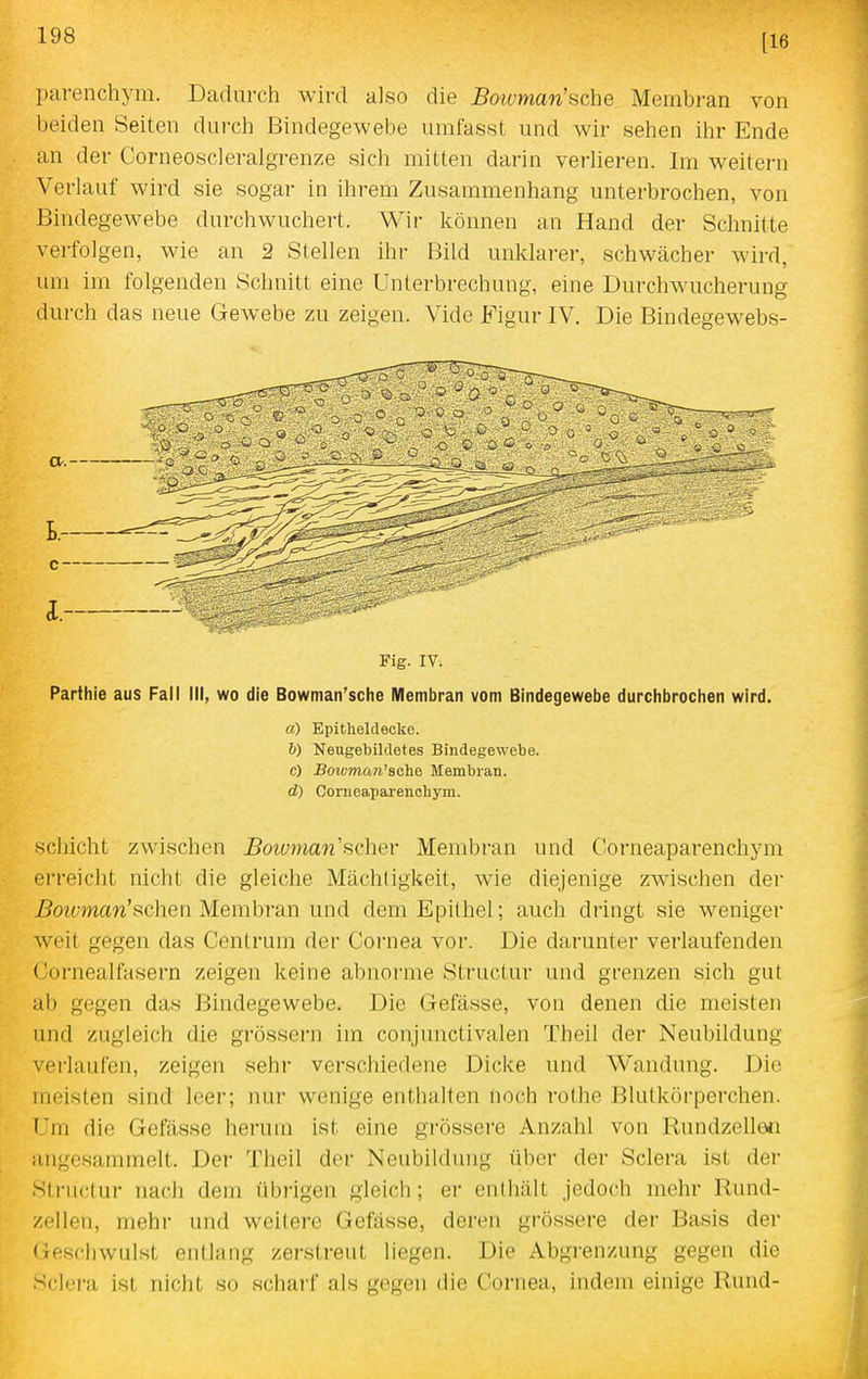 [16 parenchym. Dadurch wird also die Botvman'sche Membran von beiden Seiten durch Bindegewebe umfasst und wir sehen ihr Ende an der Corneoscleralgrenze sich mitten darin verlieren. Im weitern Verlauf wird sie sogar in ihrem Zusammenhang unterbrochen, von Bindegewebe durchwuchert. Wii- können an Hand der Schnitte verfolgen, wie an 2 Stellen ihr Bild unklarer, schwächer wird, um im folgenden Schnitt eine Unterbrechung, eine Durchwucherung durch das neue Gewebe zu zeigen. Vide Figur IV, Die Bindegewebs- Fig. IV. Parthie aus Fall III, wo die Bowman'sche Membran vom Bindegewebe durchbrochen wird. «) Epitheldecke. 6) Neugebildetes Bindegewebe. c) Boivmati'Bchß Membran. d) Corneaparenchym. Schicht zwisclien Boivmanschev Membran und Corneaparenchym erreicht nicht die gleiche Mächtigkeit, wie diejenige zwischen der j5o?(;maw'schen Membran und dem Epithel; auch dringt sie weniger weit gegen das Centrum der Cornea vor. Die darunter verlaufenden Cornealfasern zeigen keine abnorme Structur und grenzen sich gut ab gegen das Bindegewebe. Die Gefässe, von denen die meisten und zugleich die grössern im conjunctivalen Theil der Neubildung verlaufen, zeigen sehr verschiedene Dicke und Wandung. Die meisten sind leer; nur wenige enthalten noch rothe Blutkörperchen. Um die Gefässe herum ist eine grössere Anzahl von Rundzellen angesammelt. Der Theil der Neubildiuig über der Sclera ist der Stru('lur nach dem übrigen gleich; er enlhält jedoch mehr Rund- zellen, mehr und weitere Gefässe, deren grössere der Basis der Geschwulst entlang zerstreut liegen. Die Abgrenzung gegen die Sclera ist nicht so scharf als gegen die Cornea, indem einige Rund-