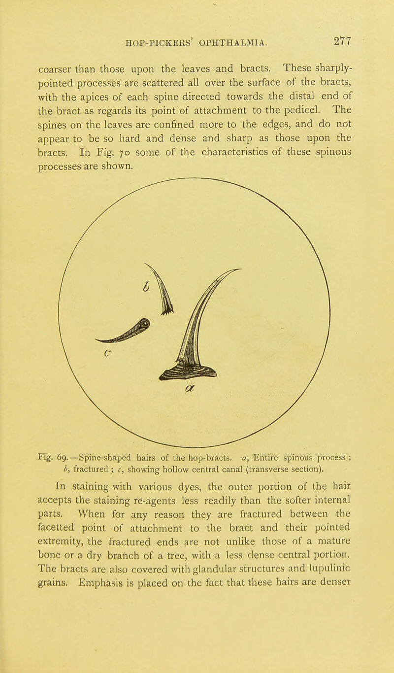 coarser than those upon the leaves and bracts. These sharply- pointed processes are scattered all over the surface of the bracts, with the apices of each spine directed towards the distal end of the bract as regards its point of attachment to the pedicel. The spines on the leaves are confined more to the edges, and do not appear to be so hard and dense and sharp as those upon the bracts. In Fig. 70 some of the characteristics of these spinous processes are shown. Fig. 69.—Spine-shaped hairs of the hop-bracts, a, Entire spinous process ; b, fractured ; c, showing hollow central canal (transverse section). In Staining with various dyes, the outer portion of the hair accepts the staining re-agents less readily than the softer internal parts. When for any reason they are fractured between the facetted point of attachment to the bract and their pointed extremity, the fractured ends are not unlike those of a mature bone or a dry branch of a tree, with a less dense central portion. The bracts are also covered with glandular structures and lupulinic grains. Emphasis is placed on the fact that these hairs are denser