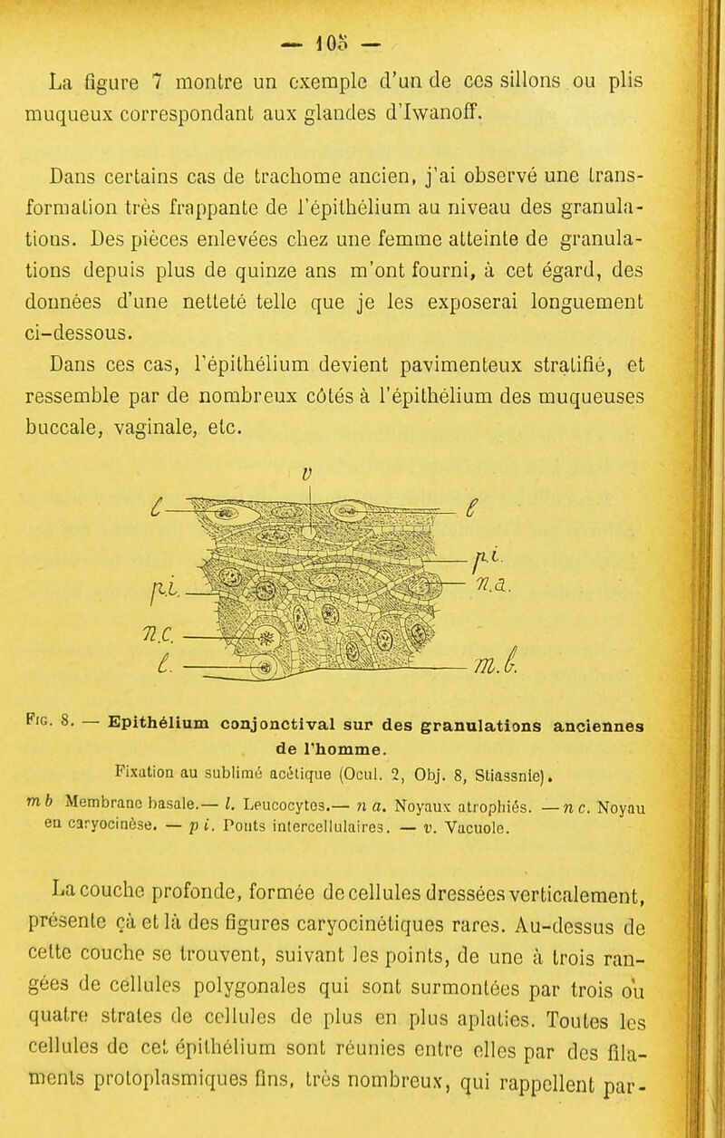 La figure 7 montre un exemple d'un de ces sillons ou plis muqueux correspondant aux glandes d'IwanofF. Dans certains cas de trachome ancien, j'ai observé une trans- formation très frappante de répilhélium au niveau des granula- tions. Des pièces enlevées chez une femme atteinte de granula- tions depuis plus de quinze ans m'ont fourni, à cet égard, des données d'une netteté telle que je les exposerai longuement ci-dessous. Dans ces cas, Tépithélium devient pavimenteux stratifié, et ressemble par de nombreux côtés à l'épithélium des muqueuses buccale, vaginale, etc. V FiG. 8. — Epithélium conjonctival sur des granulations anciennes de Thomme. Fixation au sublimé acétique (Ocul. 2, Obj. 8, Stiagsnie), mb Membrane basale.— l. Leucocytes.— n a. Noyaux atrophiés, —ne. Noyau ea caryocinèse. — p i. Pouts intercelluiaires. — v. Vacuole. La couche profonde, formée de cellules dressées verticalement, présente çà et là des figures caryocinétiques rares. Au-dessus de celte couche se trouvent, suivant les points, de une à trois ran- gées de cellules polygonales qui sont surmontées par trois ou quatre strates de cellules de plus en plus aplaties. Toutes les cellules de cet epithélium sont réunies entre elles par des fila- ments proloplasmiques fins, très nombreux, qui rappellent par-