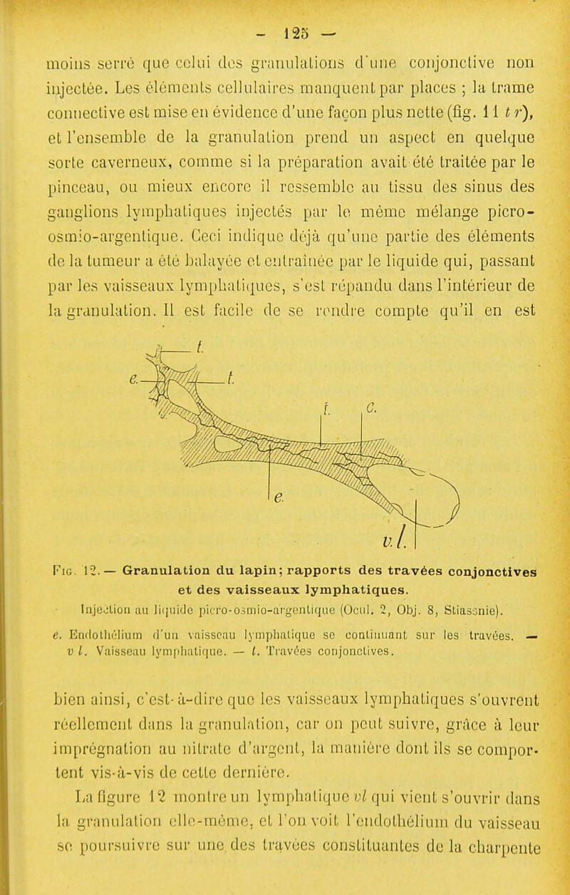 moins seiTc que celui dos graiiulalions d'une conjonctive non injectée. Les éléments cellulaires manquent par places ; la trame conneclive est mise en évidence d'une façon plus nette (fig. 11 t r), et l'ensemble de la granulation prend un aspect en quelque sorte caverneux, comme si la préparation avait été traitée par le pinceau, ou mieux encore il ressemble au tissu des sinus des ganglions lymphatiques injectés par le même mélange picro- osmio-argentique. Ceci indique déjà qu'une partie des éléments de la tumeur a été balayée et entraînée par le liquide qui, passant par les vaisseaux lympliatiijucs, s'est répandu dans l'intérieur de la granulation. 11 est facile de se rendre compte qu'il en est FiG. 12 — Granulation du lapin; rapports des travées conjonctives et des vaisseaux lymphatiques. Injejlion au ]i(juide pkro-Oimio-ai'genLique (Ocul. 2, Obj. 8, Sliasonie). e. Enclolliélium fl'uii vaisseau lymphatique se coaliuuant sur les travées. — V l. Vaisseau lymphatique. — L Travées conjonctives. bien ainsi, c'est-à-dire que les vaisseaux lymphatiques s'ouvrent réellement dans la granulation, car on peut suivre, grâce à leur imprégnation au nitrate d'argent, la manière dont ils se compor- tent vis-à-vis de cette dernière. La figure 12 montre un lymphatique (;/ qui vient s'ouvrir dans la granulation ello-raème, et l'on voit l'cndothélium du vaisseau se poursuivre sur une des travées constituantes de la charpente e.