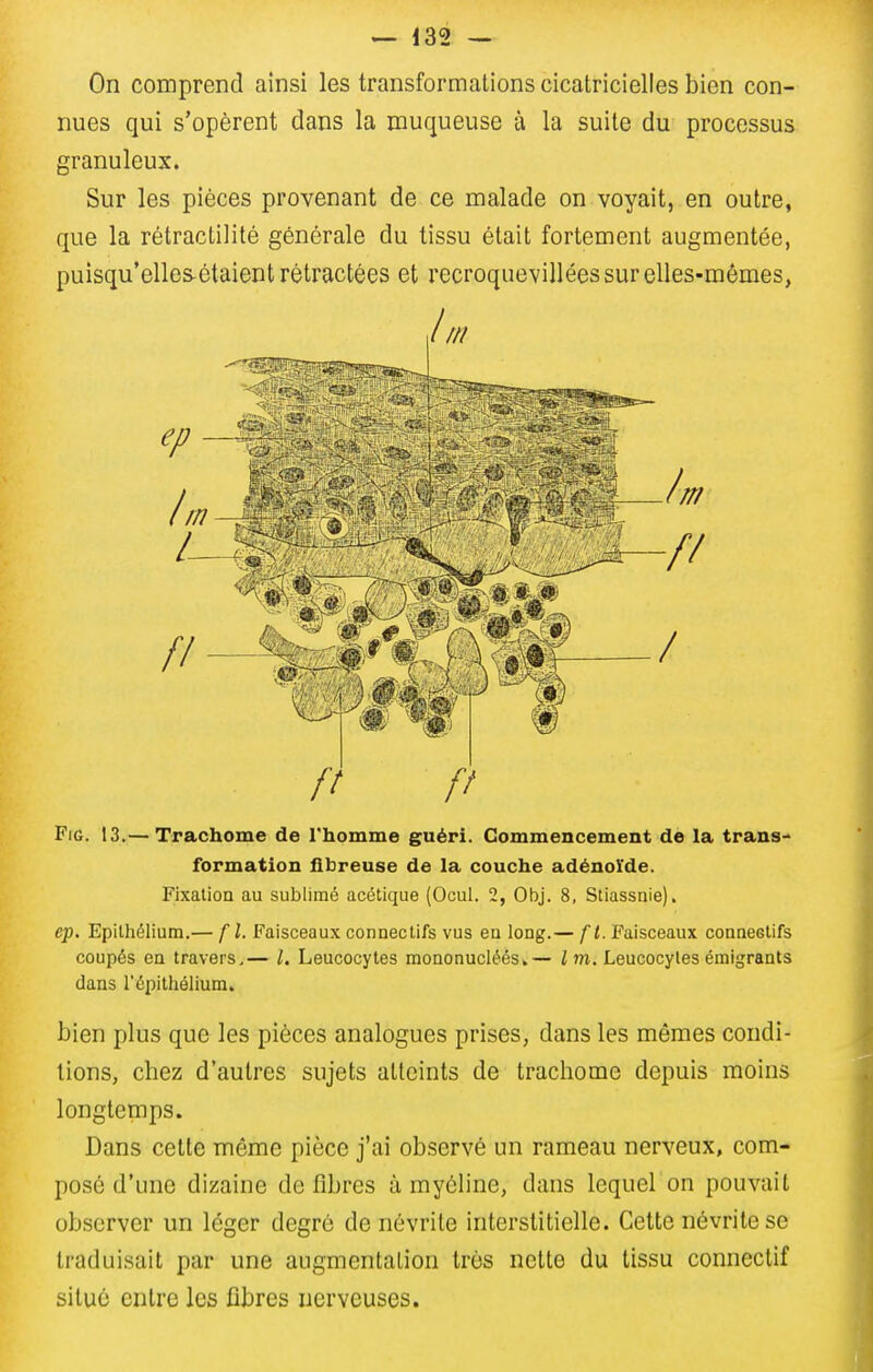 On comprend ainsi les transformations cicatricielles bien con- nues qui s'opèrent dans la muqueuse à la suite du processus granuleux. Sur les pièces provenant de ce malade on voyait, en outre, que la rétraclilité générale du tissu était fortement augmentée, puisqu'elles-étaient rétractées et recroquevillées sur elles-mêmes, I m FiG. 13.— Trachome de rhomme guéri. Commencement de la trans- formation fibreuse de la couche adénoïde. Fixation au sublimé acétique (Ocul. 2, Obj. 8, Stiassaie). ep. Epilhélium.— fl. Faisceaux connectifs vus eu long.— fi. Faisceaux conneGlifs coupés en travers.— Leucocytes mononucléés»— Im. Leucocytesémigrants dans l'épithélium. bien plus que les pièces analogues prises, dans les mêmes condi- tions, chez d'autres sujets atteints de trachome depuis moins longtemps. Dans celte môme pièce j'ai observé un rameau nerveux, com- posé d'une dizaine défibres à myéline, dans lequel on pouvait observer un léger degré de névrite interstitielle. Cette névrite se traduisait par une augmentation très nette du tissu conneclif situé entre les fibres nerveuses.