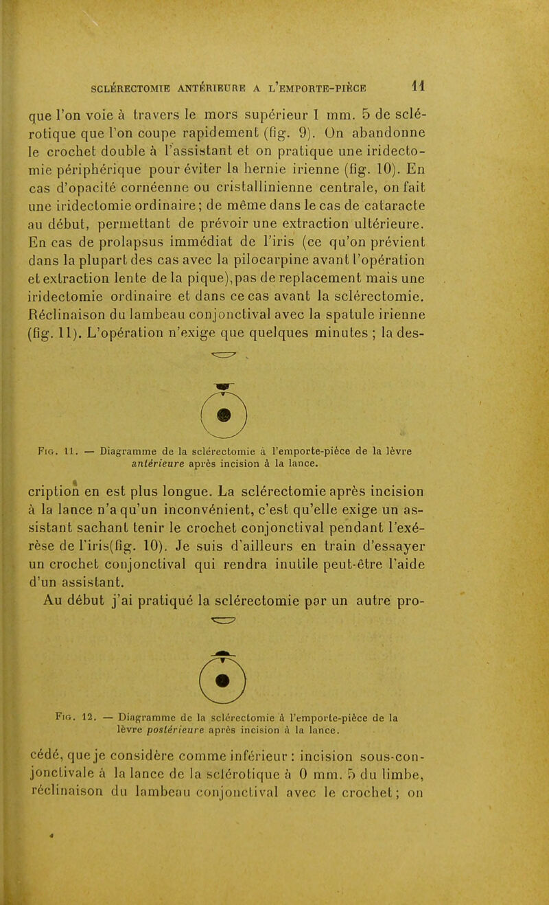 que l'on voie à travers le mors supérieur 1 mm. 5 de sclé- rotique que l'on coupe rapidement (fig. 9). On abandonne le crochet double à l'assistant et on pratique une iridecto- mie périphérique pour éviter la hernie irienne (fig. 10). En cas d'opacité cornéenne ou cristallinienne centrale, on fait une iridectomie ordinaire ; de même dans le cas de cataracte au début, permettant de prévoir une extraction ultérieure. En cas de prolapsus immédiat de l'iris (ce qu'on prévient dans la plupart des cas avec la pilocarpine avant l'opération et extraction lente de la pique),pas de replacement mais une iridectomie ordinaire et dans ce cas avant la sclérectomie. Réclinaison du lambeau conjonctival avec la spatule irienne (fig. 11). L'opération n'exige que quelques minutes ; la des- FiG. 11. — Diagramme de la sclérectomie à l'emporte-pièce de la lèvre antérieure après incision à la lance. cription en est plus longue. La sclérectomie après incision à la lance n'a qu'un inconvénient, c'est qu'elle exige un as- sistant sachant tenir le crochet conjonctival pendant l'exé- rèse de riris(fig. 10). Je suis d'ailleurs en train d'essayer un crochet conjonctival qui rendra inutile peut-être l'aide d'un assistant. Au début j'ai pratiqué la sclérectomie par un autre pro- FiG. 12. — Diujïramme de la sclérectomie à l'emporte-pièce de la lèvre postérieure après incision à la lance. cédé, que je considère comme inférieur : incision sous-con- jonctivale à la lance de la sclérotique à 0 mm. 5 du limbe, réclinaison du lambeau conjonctival avec le crochet; on 4