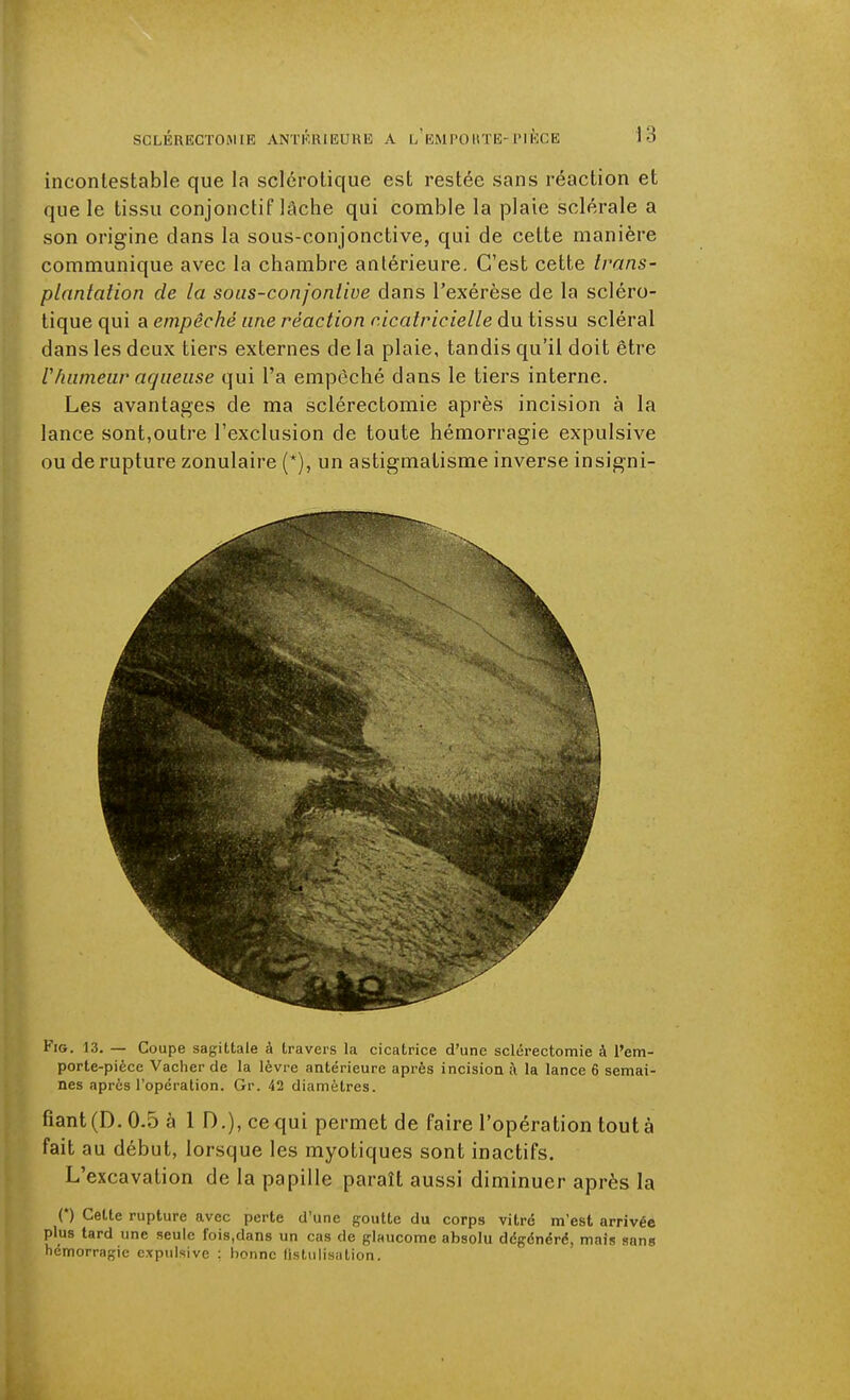 incontestable que la sclérotique est restée sans réaction et que le tissu conjonctif lâche qui comble la plaie sclérale a son origine dans la sous-conjonctive, qui de cette manière communique avec la chambre antérieure. C'est cette trans- plantation de la sous-conjontive dans l'exérèse de la scléro- tique qui a empêché une réaction cicatricielle du tissu scléral dans les deux tiers externes de la plaie, tandis qu'il doit être rhumeur acjlieuse qui l'a empêché dans le tiers interne. Les avantages de ma sclérectomie après incision à la lance sont,outre l'exclusion de toute hémorragie expulsive ou de rupture zonulaire (*), un astigmatisme inverse insigni- FiG. 13. — Coupe sagittale à travers la cicatrice d'une sclérectomie à l'em- porte-pièce Vacher de la lèvre antérieure après incision à la lance 6 semai- nes après l'opération. Gr. 42 diamètres. fiant (D. 0.5 à 1 D.), ce qui permet de faire l'opération tout à fait au début, lorsque les myotiques sont inactifs. L'excavation de la papille paraît aussi diminuer après la (*) Cette rupture avec perte d'une goutte du corps vitré m'est arrivée plus tard une seule fois.dans un cas de glaucome absolu dégénéré, mais sans hémorragie expulsive : bonne listulisation.