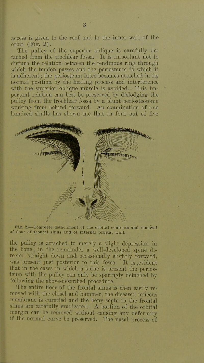 access is given to the roof and to the inner wall of the orbit (Fig. 2). The pulle}^ of the superior oblique is carefully de- tached from the trochlear fossa. It is important not to disturb the relation between the tendinous ring through which the tendon passes and the periosteum to which it is adherent; the periosteum later becomes attached in its normal position by the healing process and interference with the superior oblique muscle is avoided. • This im- portant relation can best be preserved by dislodging the pulley from the trochlear fossa b)^ a blunt periosteotome working from behind forward. An examination of one hundred skulls has shown mc that in four out of five Fig. 2.—Cotnplele detacliiuent of the orbital contents and removal of floor of frontal sinus and of internal orbital wall. the pulley is attached to merely a slight depression in the bone; in the remainder a well-developed spine di- rected straight down and occasionally slightly forward, was present just posterior to this fossa. It is .evident that in the cases in which a spine is present the perios- teum with the pulley can only be sparingly detached by following the above-described procedure. The entire floor of the frontal sinus is then easily re- moved with the chisel and hammer, the diseased mucous membrane is curetted and the bony septa in the frontal sinus are carefully eradicated. A portion of the orbital margin can be removed without causing any deformity if the normal curve be preserved. The nasal process of