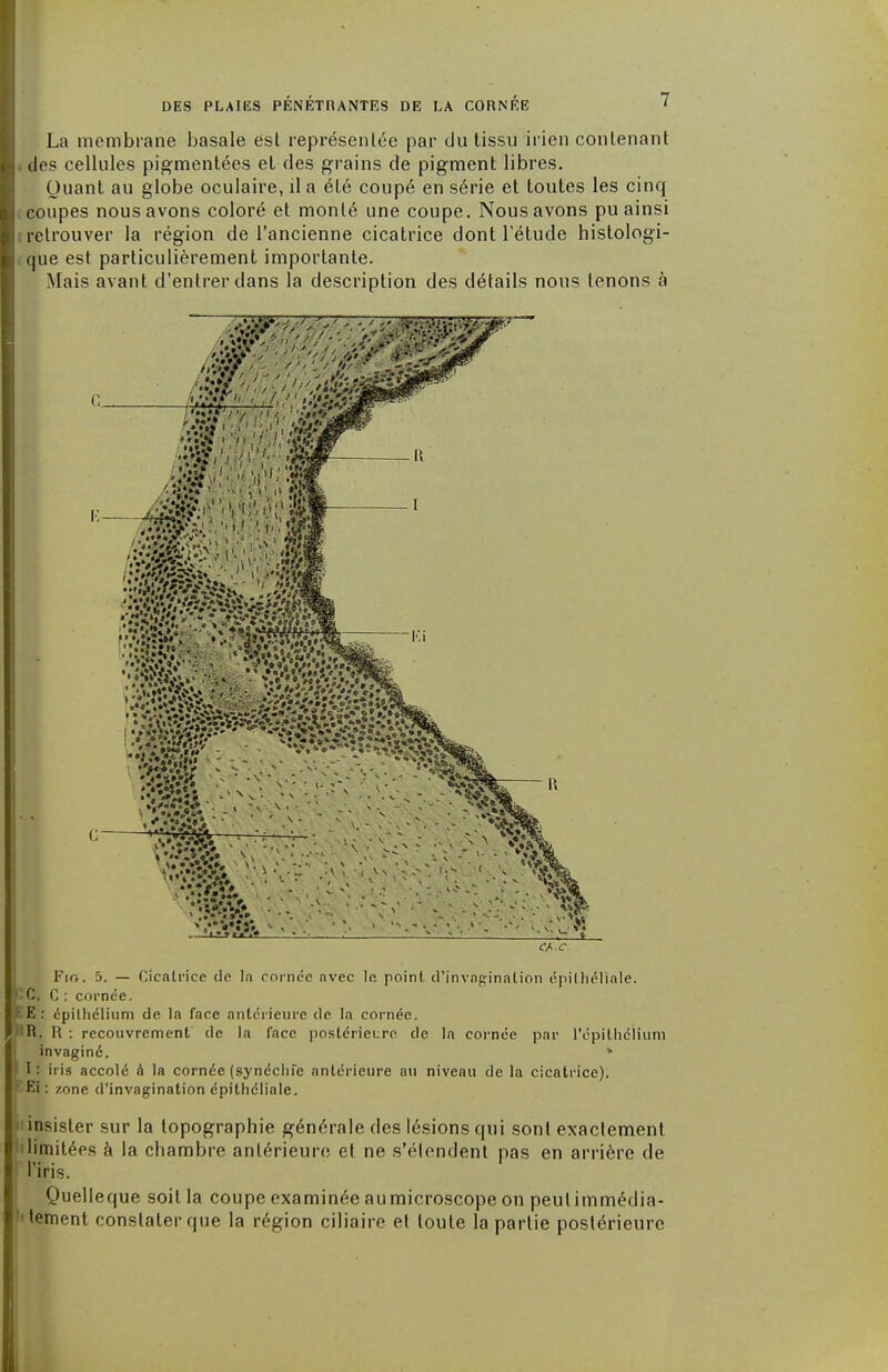 La membrane basale est représentée par du tissu irien contenant des cellules pigmentées et des grains de pigment libres. Quant au globe oculaire, il a été coupé en série et toutes les cinq coupes nous avons coloré et monté une coupe. Nous avons pu ainsi retrouver la région de l'ancienne cicatrice dont l'étude histologi- que est particulièrement importante. Mais avant d'entrer dans la description des détails nous tenons à G. Fio. 5. — Cicatrice de la coince avec le. point d'invagination épithéliale. BÇ, C : cornée. E : épilhélium de la face antérieure de la cornée. fi. H : recouvrement de la face postérieure de la cornée par l'épithélium invaginé. » f I: iris accolé à la cornée (synéchfe antérieure au niveau de la cicatrice). SEf: zone d'invagination épithéliale. insister sur la topographie générale des lésions qui sont exactement limitées à la chambre antérieure et ne s'étendent pas en arrière de I l'iris. Quelleque soit la coupe examinée aumicroscope on peut immédia- tement constater que la région ciliaire et toute la partie postérieure