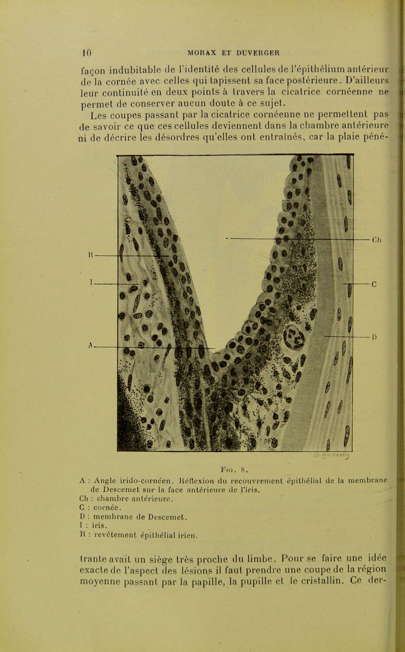 façon indubitable de l'identité des cellules de l'épithélium antérieur de la cornée avec celles qui tapissent sa face postérieure. D'ailleurs leur continuité en deux points à travers la cicatrice cornéenne ne permet de conserver aucun doute à ce sujet. Les coupes passant par la cicatrice cornéenne ne permettent pas de savoir ce que ces cellules deviennent dans la chambre antérieure ni de décrire les désordres qu'elles ont entraînés, car la plaie péné- Fio. s. A : Angle irido-cornéen. Réflexion du recouvrement épithélial de la membrane de Descemet sur la face antérieure de l'iris. Ch : chambre antérieure. C : cornée. D : membrane de Descemet. I : iris. H : revêtement épithélial irien. liante avait un siège très proche du limbe. Pour se faire une idée exacte de l'aspect des lésions il faut prendre une coupe de la région moyenne passant par la papille, la pupille et le cristallin. Ce der-