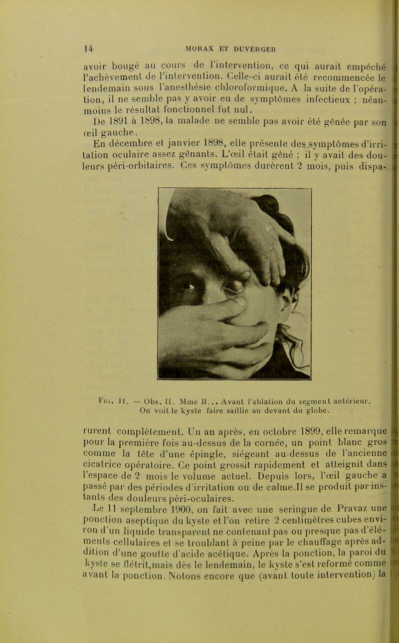 avoir bougé au cours de l'intervention, ce qui aurait empêché l'achèvement de l'intervention. Celle-ci aurait été recommencée le lendemain sous l'aneslhésie chloroformique. A la suite de l'opéra- tion, il ne semble pas y avoir eu de symptômes infectieux ; néan- moins le résultat fonctionnel fut nul. De 1891 à 1898, la malade ne semble pas avoir été gênée par son œil gauche. En décembre et janvier 1898, elle présente des.symptômes d'irri- tation oculaire assez gênants. L'œil était gêné ; il y avait des dou- leurs péri-orbitaires. Ces symptômes durèrent 2 mois, puis dispa- Kig. H. — Obs. II. Mme B... Avant l'ablation du segment antérieur. On voit le kyste faire saillie au devant du globe. rurent complètement. Un an après, en octobre 1899, elle remarque pour la première fois au-dessus de la cornée, un point blanc gros comme la tête d'une épingle, siégeant au-dessus de l'ancienne cicatrice opératoire. Ce point grossit rapidement et atteignit dans l'espace de 2 mois le volume actuel. Depuis lors, l'œil gauche a passé par des périodes d'irritation ou de calme.Il se produit par ins- tants des douleurs péri-oculaires. Le 11 septembre 1900, on fait avec une seringue de Pravaz une ponction aseptique du kyste et l'on relire 2 centimètres cubes envi- ron d'un liquide transparent ne contenant pas ou presque pasd'élé- menls cellulaires et se troublanl à peine par le chauffage après ad- dition d'une goutle d'acide acétique. Après la ponction, la paroi du l<ysle se flélril.mais dès le lendemain, le kyste s'est reformé comme avant la ponction. Notons encore que (avant loule intervention) la
