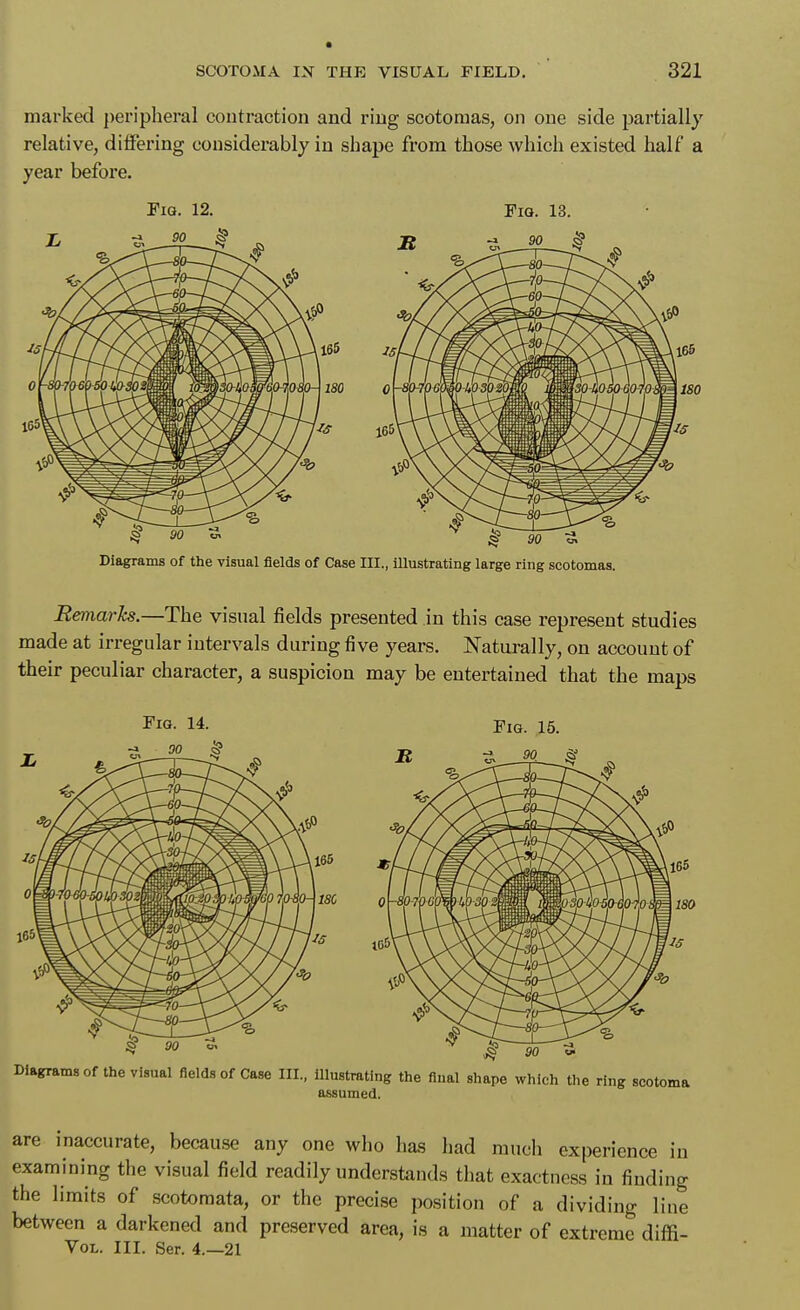 marked ])eripheral contraction and ring scotomas, on one side partially relative, differing considerably in shape from those which existed half a year before. Pig. 12. Pig. 13. Diagrams of the visual fields of Case III., illustrating large ring scotomas. Bemarks.—The visual fields presented in this case represent studies made at irregular intervals during five years. Naturally, on account of their peculiar character, a suspicion may be entertained that the maps Pig- 14. Pig. 15. Diagrams of the visual fields of Case III., illustrating the final shape which the ring scotoma a.ssumed. are inaccurate, because any one who has had much experience in examining the visual field readily understands that exactness in finding the limits of scotoraata, or the precise position of a dividing line between a darkened and preserved area, is a matter of extreme diffi- VoL. III. Ser. 4.—21