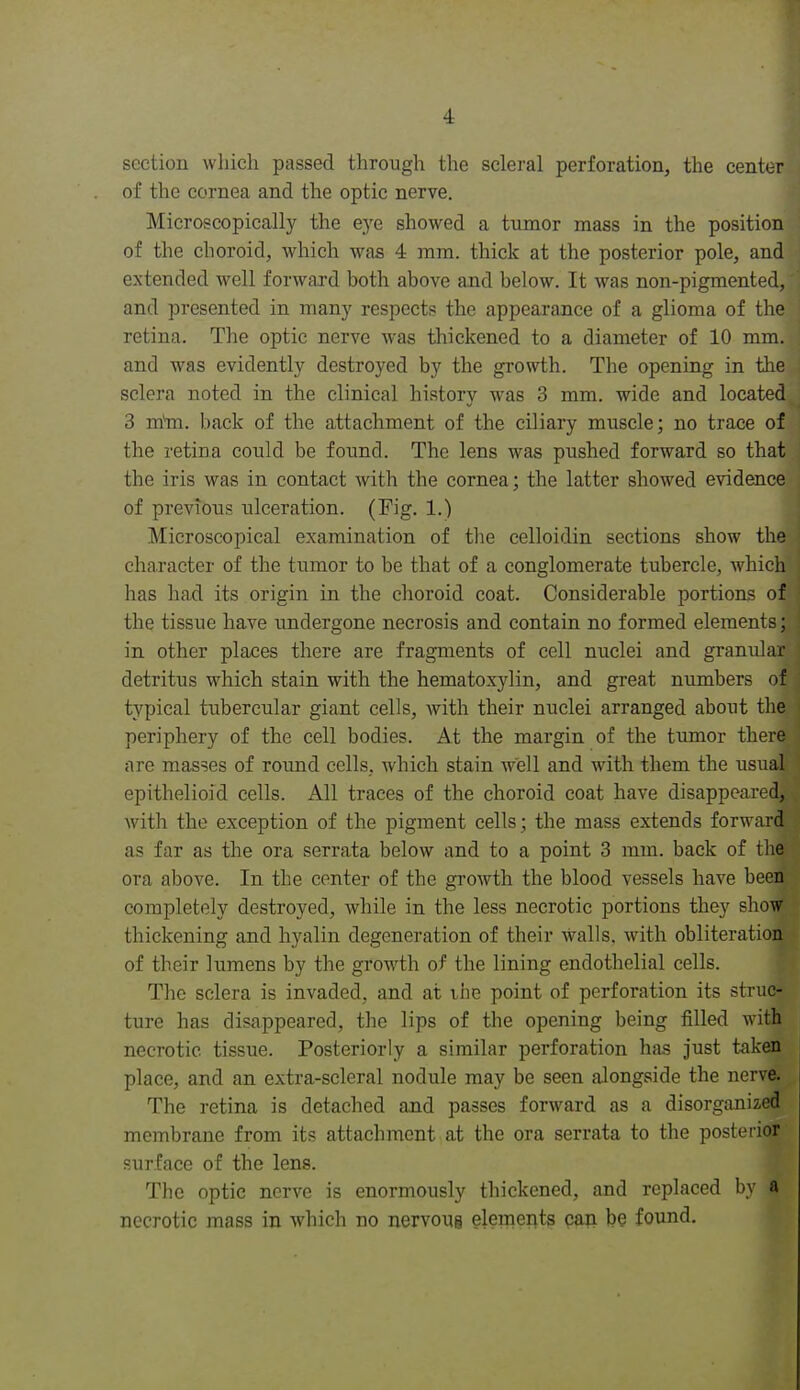 section which passed through the scleral perforation, the center of the cornea and the optic nerve. Microscopically the e.ye showed a tumor mass in the position of the choroid, which was 4 ram. thick at the posterior pole, and extended well forward both above and below. It was non-pigmented, and presented in many respects the appearance of a glioma of the retina. The optic nerve was thickened to a diameter of 10 mm. and was evidently destroyed by the growth. The opening in the sclera noted in the clinical history was 3 mm. wide and located 3 Txim. back of the attachment of the ciliary muscle; no trace of the retina could be found. The lens was pushed forward so that the iris was in contact with the cornea; the latter showed evidence of previous ulceration. (Fig. 1.) Microscopical examination of the celloidin sections show the character of the tumor to be that of a conglomerate tubercle, which has had its origin in the choroid coat. Considerable portions of the tissue have undergone necrosis and contain no formed elements; in other places there are fragments of cell nuclei and granular detritus which stain with the hematoxylin, and great numbers of typical tubercular giant cells, with their nuclei arranged about the periphery of the cell bodies. At the margin of the tumor there are masses of round cells, which stain well and with them the usual epithelioid cells. All traces of the choroid coat have disappeared, with the exception of the pigment cells; the mass extends forward as far as the ora serrata below and to a point 3 mm. back of the ora above. In the center of the growth the blood vessels have been completely destroyed, while in the less necrotic portions they show thickening and hyalin degeneration of their walls, with obliteration of their lumens by the grow^th of the lining endothelial cells. The sclera is invaded, and at vhe point of perforation its struc- ture has disappeared, the lips of the opening being filled with necrotic tissue. Posteriorly a similar perforation has just taken place, and an extra-scleral nodule may be seen alongside the nerve. The retina is detached and passes forward as a disorganized membrane from its attachment at the ora serrata to the postei-ior surface of the lens. The optic nerve is enormously thickened, and replaced by a necrotic mass in which no nervoug elements can be found.