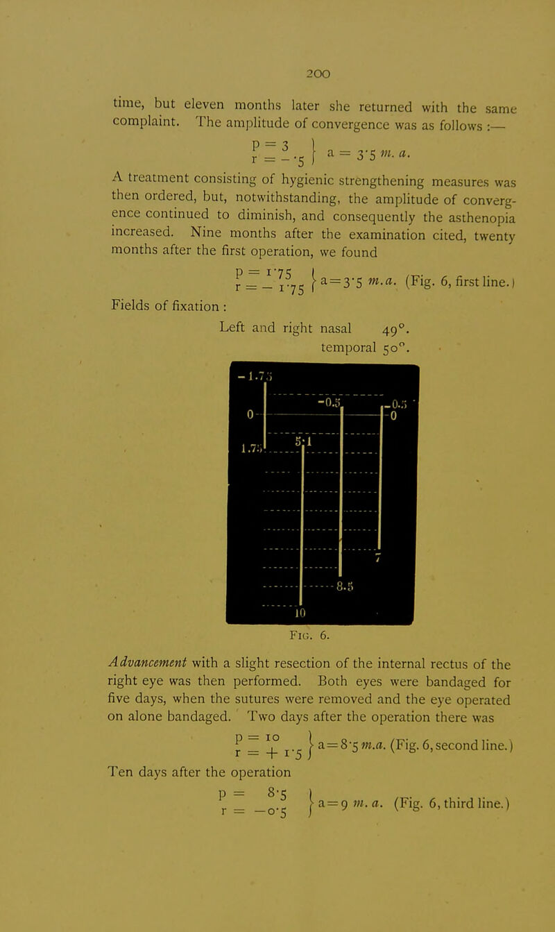 time, but eleven months later she returned with the same complaint. The amplitude of convergence was as follows :— P = 3 r = -'5 a = 3-5 m. a. A treatment consisting of hygienic strengthening measures was then ordered, but, notwithstanding, the amplitude of converg- ence continued to diminish, and consequently the asthenopia increased. Nine months after the examination cited, twenty months after the first operation, we found fr^!^ [a=3'5 m.a. (Fig. 6, first line.) Fields of fixation: Left and right nasal 49°. temporal 500. Fig. 6. Advancement with a slight resection of the internal rectus of the right eye was then performed. Both eyes were bandaged for five days, when the sutures were removed and the eye operated on alone bandaged. Two days after the operation there was j? ~ + 1-5 |a=8'5w.«. (Fig. 6, second line.) Ten days after the operation a = 9 m.a. (Fig. 6, third line.)