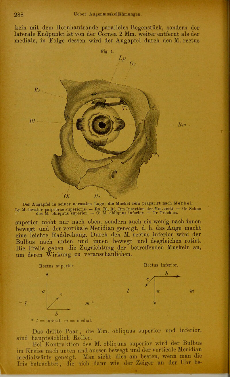 kein mit dem Hornhautrande paralleles Bogenstück, sondern der laterale Endpunkt ist von der Cornea 2 Mm. weiter entfernt als der mediale, in Folge dessen wird der Augapfel durch den M. rectus Fig. 1. Lp Os Ri RJ Rm Der Augapfel in seiner normalen Lage; die Muskel rein präparirt nach Merkel. Lp M. levator palpebrae snperioris. — Bs. El, Ei, Em Insertion der Mm. recti. — Os Sehne des M. obliquns superior. — Oi M. obliquns inferior. — Tr Trochlea. superior nicht nur nach oben, sondern auch ein wenig nach innen bewegt und der vertikale Meridian geneigt, d. h. das Auge macht eine leichte E-addrehung. Durch den M. rectus inferior wird der Bulbus nach unten und innen bewegt und desgleichen rotirt. Die Pfeile geben die Zugrichtung der betreffenden Muskeln an, um deren Wirkung zu veranschaulichen. Rectus superior. a Rectus inferior. b ^ DI (I m h * l — lateral, m = medial. Das dritte Paar, die Mm. obliquus superior und inferior, sind hauptsächlich Roller. Bei Kontraktion des M. obliquus superior wird der Bulbus im Kreise nach unten und aussen bewegt und der verticale Meridian medialwärts geneigt. Man sieht dies am besten, wenn man die Iris betrachtet, die sich dann wie der Zeiger an der Uhr be-