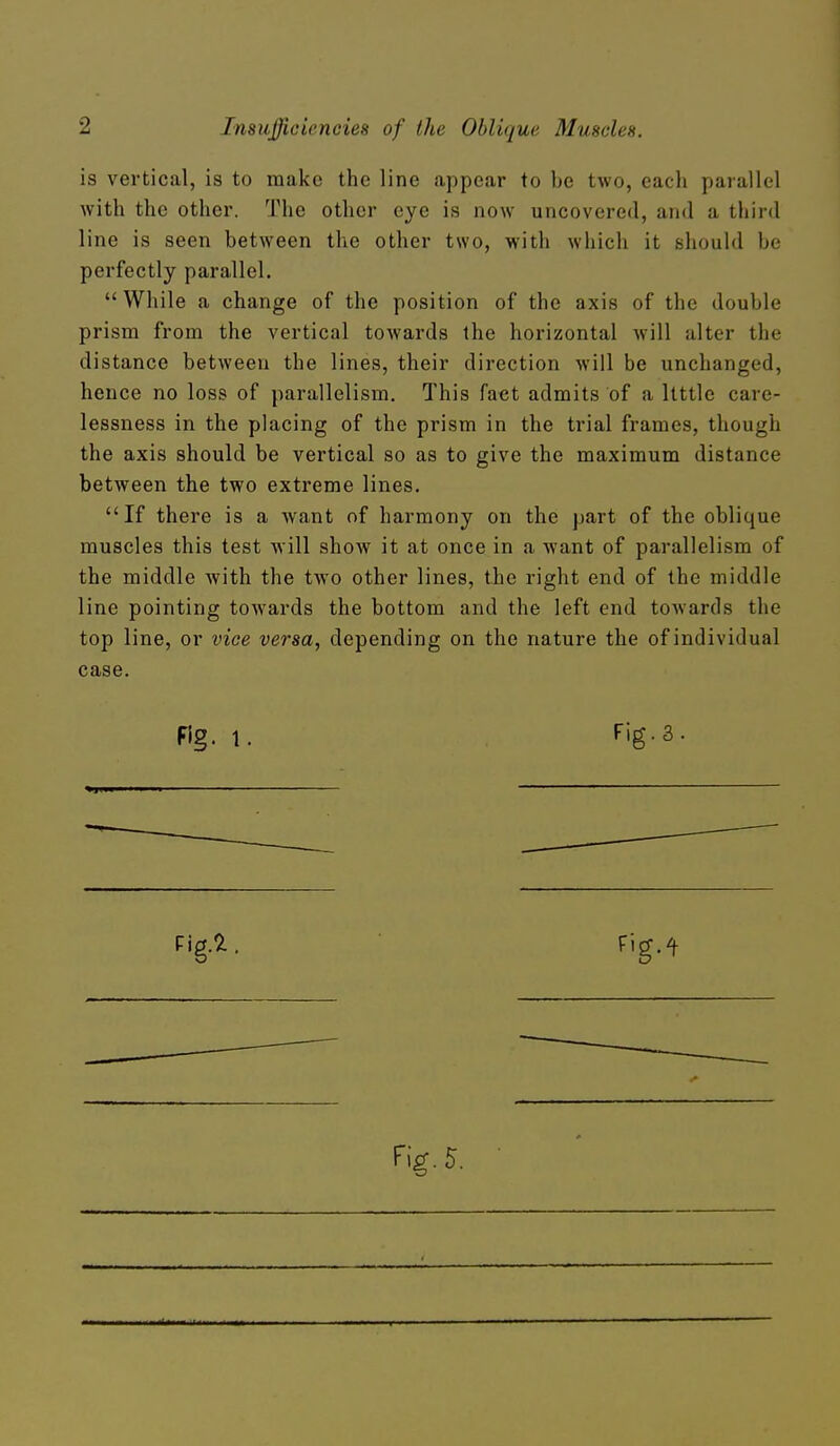 is vertical, is to make the line appear to be two, each parallel with the other. The other eye is now uncovered, and a third line is seen between the other two, with wliich it should be perfectly parallel.  While a change of the position of the axis of the double prism from the vertical towards the horizontal will alter the distance between the lines, their direction will be unchanged, hence no loss of parallelism. This fact admits of a Itttlc care- lessness in the placing of the prism in the trial frames, though the axis should be vertical so as to give the maximum distance between the two extreme lines. If there is a want of harmony on the part of the oblique muscles this test will show it at once in a want of parallelism of the middle with the two other lines, the right end of the middle line pointing towards the bottom and the left end towards the top line, or vice versa, depending on the nature the of individual case. Fig. 1. Fig.3.