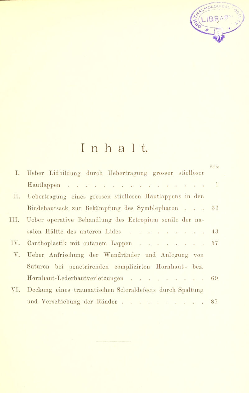 Inhalt. Seite I. Ueber Lidbildung durch Uebertragung grosser stielloser Hautlappen 1 IL. Uebertragung eines grossen stiellosen Hautlappcns in den Bindehautsack zur Bekämpfung des Symblepharon . . . 33 III. Ueber operative Behandlung des Ectropium senile der na- salen Hälfte des unteren Lides 43 IV. Canthoplastik mit cutanem Lappen 57 Y. Ueber Anfrischung der Wundränder und Anlegung von Suturen bei penetrirenden complicirten Hornhaut- bez. Hornhaut-Lederhautverletzungen 69 VI. Deckung eines traumatischen Scleraldefects durch Spaltung und Verschiebung der Ränder 87