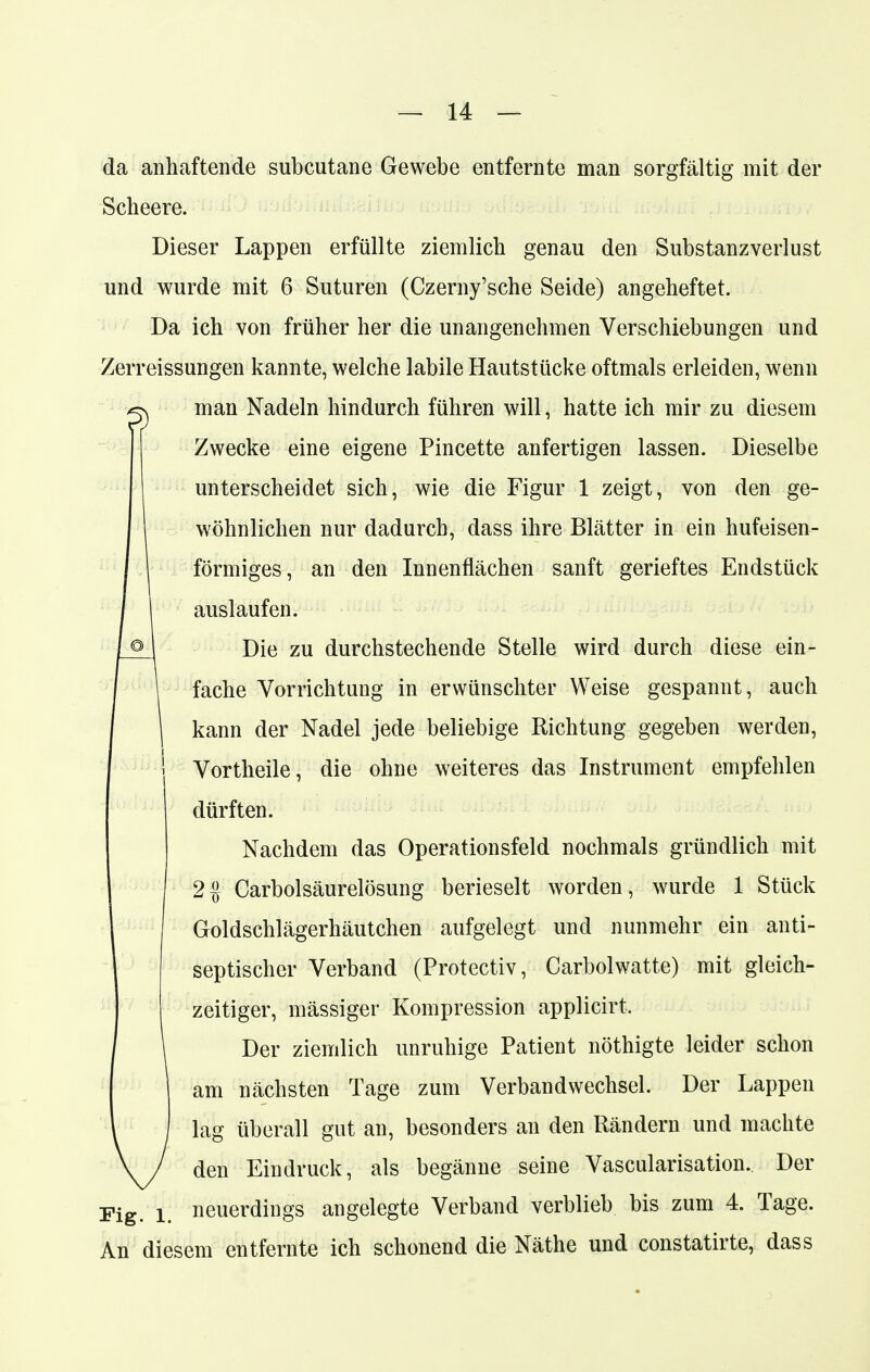 da anhaftende subcutane Gewebe entfernte man sorgfältig mit der Scheere. Dieser Lappen erfüllte ziemlich genau den Substanzverlust und wurde mit 6 Suturen (Czerny'sche Seide) angeheftet. Da ich von früher her die unangenehmen Verschiebungen und Zerreissungen kannte, welche labile Hautstücke oftmals erleiden, wenn g man Nadeln hindurch führen will, hatte ich mir zu diesem Zwecke eine eigene Pincette anfertigen lassen. Dieselbe unterscheidet sich, wie die Figur 1 zeigt, von den ge- wöhnlichen nur dadurch, dass ihre Blätter in ein hufeisen- förmiges, an den Innenflächen sanft gerieftes Endstück auslaufen. Die zu durchstechende Stelle wird durch diese ein- fache Vorrichtung in erwünschter Weise gespannt, auch kann der Nadel jede beliebige Richtung gegeben werden, Vortheile, die ohne weiteres das Instrument empfehlen dürften. Nachdem das Operationsfeld nochmals gründlich mit 2% Carbolsäurelösung berieselt worden, wurde 1 Stück Goldschlägerhäutchen aufgelegt und nunmehr ein anti- septischer Verband (Protectiv, Carbolwatte) mit gleich- zeitiger, massiger Kompression applicirt. Der ziemlich unruhige Patient nöthigte leider schon am nächsten Tage zum Verbandwechsel. Der Lappen lag überall gut an, besonders an den Rändern und machte den Eindruck, als begänne seine Vascularisation.. Der neuerdings angelegte Verband verblieb bis zum 4. Tage. An diesem entfernte ich schonend die Näthe und constatirte, dass Fig. l.