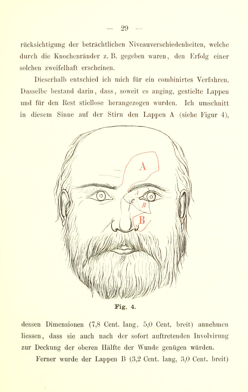 rücksichtigung der beträchtlichen Niveauverschiedenheiten, welche durch die Knochenränder z. B. gegeben waren, den Erfolg einer solchen zweifelhaft erscheinen. Dieserhalb entschied ich mich für ein combinirtes Verfahren. Dasselbe bestand darin, dass, soweit es anging, gestielte Lappen und für den Rest stiellose herangezogen wurden. Ich umschnitt in diesem Sinne auf der Stirn den Lappen A (siehe Figur 4), Fig. 4. dessen Dimensionen (7,8 Cent, lang, 5,0 Cent, breit) annehmen Hessen, dass sie auch nach der sofort auftretenden Involvirung zur Deckung der oberen Hälfte der Wunde genügen würden. Ferner wurde der Lappen B (3,2 Cent, lang, 3,0 Cent, breit)