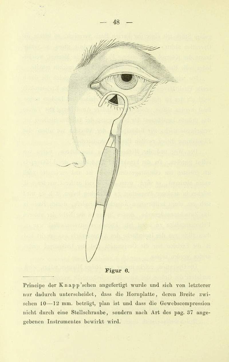 Figur 6. Principe der K n ap p'sehen angefertigt wurde und sich von letzterer nur dadurch unterscheidet, dass die Hornplatte, deren Breite zwi- schen 10—12 mm. beträgt, plan ist und dass die Gewebscompression nicht durch eine Stellschraube, sondern nach Art des pag. 37 ange- gebenen Instrumentes bewirkt wird.