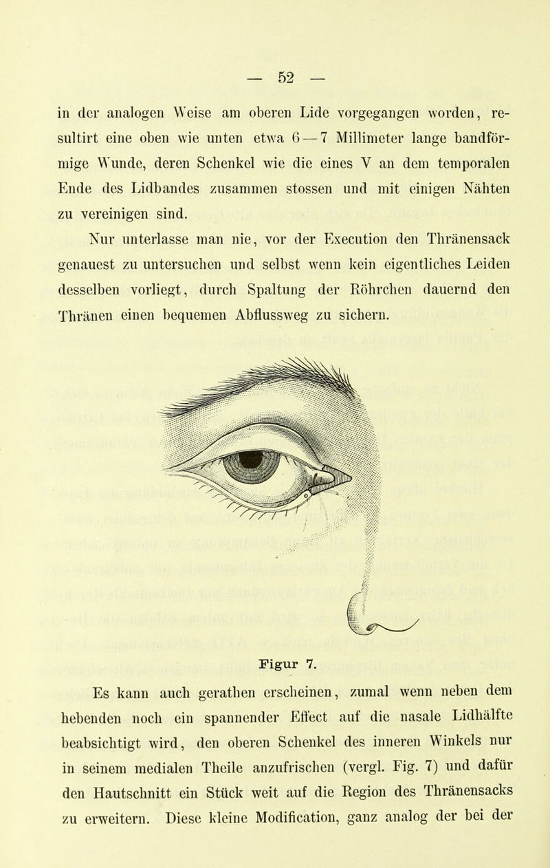 in der analogen Weise am oberen Lide vorgegangen worden, re- sultirt eine oben wie unten etwa 6 — 7 Millimeter lange bandför- mige Wunde, deren Schenkel wie die eines V an dem temporalen Ende des Lidbandes zusammen stossen und mit einigen Nähten zu vereinigen sind. Nur unterlasse man nie, vor der Execution den Thränensack genauest zu untersuchen und selbst wenn kein eigentliches Leiden desselben vorliegt, durch Spaltung der Röhrchen dauernd den Thränen einen bequemen Abflussweg zu sichern. Figur 7. Es kann auch gerathen erscheinen, zumal wenn neben dem hebenden noch ein spannender Effect auf die nasale Lidhälfte beabsichtigt wird, den oberen Schenkel des inneren Winkels nur in seinem medialen Theile anzufrischen (vergl. Fig. 7) und dafür den Hautschnitt ein Stück weit auf die Region des Thränensacks zu erweitern. Diese kleine Modifikation, ganz analog der bei der