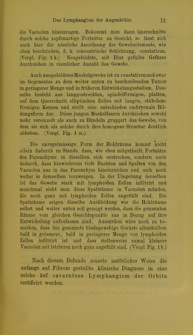 die Vacuolen hineinragen. Bekommt man dann Querschnitte durch solche zapfenartige Fortsätze zu Gesicht, so lässt sich auch hier die nämliche Anordnung der Gewebselemente, wie ohen beschrieben, d. h. concentrische Schichtung, constatiren. (Vergl. Fig. 1 k.) Neugebildete, mit Blut gefüllte Gefässe durchziehen in ziemlicher Anzahl das Gewebe. Auch neugebildetes Muskelgewebe ist zu constatiren und zwar im Gegensatze zu dem weiter unten zu beschreibenden Tumor in geringerer Menge und in früheren Entwickelungsstadien. Das- selbe besteht aus langgestreckten, spindelförmigen, platten, auf dem Querschnitt elliptischen Zellen mit langen, stäbchen- förmigen Kernen und stellt eine entschieden embryonale Bil- dungsform dar. Diese jungen Muskelfasern durchziehen sowohl mehr vereinzelt als auch zu Bündeln gruppirt das Gewebe, von dem sie sich als solche durch ihre homogene Structur deutlich abheben. (Vergl. Fig. 1 m.) Die unregelmässige Form der Hohlräume kommt nicht allein dadurch zu Stande, dass, wie eben mitgetheilt, Fortsätze des Parenchyms in dieselben sich erstrecken, sondern auch dadurch, dass hinwiederum tiefe Buchten und Spalten von den Vacuolen aus in das Parenchym hineinreichen und sich noch weiter in demselben verzweigen. In der Umgebung derselben ist das Gewebe stark mit lymphoiden Zellen infiltrirt und manchmal sieht man diese Spalträume in Vacuolen münden, die noch ganz mit lymphoiden Zellen angefüllt sind. Die Spalträume zeigen dieselbe Auskleidung wie die Hohlräume selbst und weiter unten soll gezeigt werden, dass'die genannten Räume vom gleichen Gesichtspunkte aus in Bezug auf ihre Entwickelung aufzufassen sind. Ausserdem wäre noch zu be- merken, dass das gesammte bindegewebige Gerüste allenthalben bald in grösserer, bald in geringerer Menge von lymphoiden Zellen infiltrirt ist und dass stellenweise zumal kleinere Vacuolen mit letzteren noch ganz angefüllt sind. (Vergl Fig. 1 b.) Nach diesem Befunde niusste natürlicher Weise die anfangs auf Fibrom gestellte klinische Diagnose in eine solche äuf cavernöses Lymphangiom der Orbita rectificirt werden.