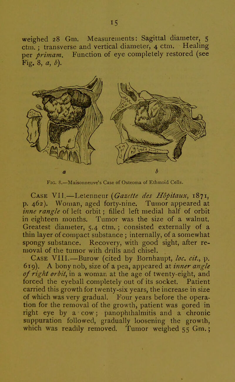 weighed 28 Gm. Measurements: Sagittal diameter, 5 ctm. ; transverse and vertical diameter, 4 ctm. Healing per primani. Function of eye completely restored (see Fig. 8, a, b). Fig. 8.—Maisonneuve's Case of Osteoma of Ethmoid Cells. Case VII.—Letenneur {Gazette des Hopitaux, 1871, p. 462). Woman, aged forty-nine. Tumor appeared at inne rangle of left orbit; filled left medial half of orbit in eighteen months. Tumor was the size of a walnut. Greatest diameter, 5.4 ctm. ; consisted externally of a thin layer of compact substance; internally, of a somewhat spongy substance. Recovery, with good sight, after re- moval of the tumor with drills and chisel. Case VIII.—Burow (cited by Bornhaupt, loc. cit., p. 619). A bony nob, size of a pea, appeared at infier a?igle of right orbit, in a woman at the age of twenty-eight, and forced the eyeball completely out of its socket. Patient carried this growth for twenty-six years, the increase in size of which was very gradual. Four years before the opera- tion for the removal of the growth, patient was gored in right eye by a cow; panophthalmitis and a chronic suppuration followed, gradually loosening the growth, which was readily removed. Tumor weighed 55 Gm.;