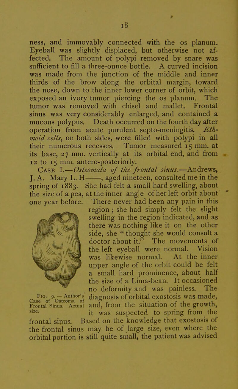 ness, and immovably connected with the os planum. Eyeball was slightly displaced, but otherwise not af- fected. The amount of polypi removed by snare was sufficient to fill a three-ounce bottle. A curved incision was made from the junction of the middle and inner thirds of the brow along the orbital margin, toward the nose, down to the inner lower corner of orbit, which exposed an ivory tumor piercing the os ))lanum. The tumor was removed with chisel and mallet. Frontal sinus was very considerably enlarged, and contained a mucous polypus. Death occurred on the fourth day after operation from acute purulent septo-meningitis. Eth- moid cells, on both sides, were filled with polypi in all their numerous recesses. Tumor measured 15 mm. at its base, 27 mm. vertically at its orbital end, and from 12 to 15 mm. antero-posteriorly. Case I.—Osieomata of the frojital sinus.—Andrews, J. A. Mary L. H , aged nineteen, consulted me in the spring of 1883. She had felt a small hard swelling, about the size of a pea, at the inner angle of her left orbit about one year before. There never had been any pain in this region ; she had simply felt the slight swelling in the region indicated, and as there was nothing like it on the other side, she  thought she would consult a doctor about it. The n)ovements of the left eyeball were normal. Vision was likewise normal. At the inner upper angle of the orbit could be felt a small hard prominence, about half the size of a Lima-bean. It occasioned no deformity and was painless. The Fig. 9. — Author's diagnosis of Orbital exostosis was made, Case of Osteoma of  ^ , . . ^ .1 Frontal Sinus. Actual and, froin the Situation ot the growth, it was suspected to sjiring from the frontal sinus. Based on the knowledge that exostosis of the frontal sinus may be of large size, even where the orbital portion is still quite small, the patient was advised