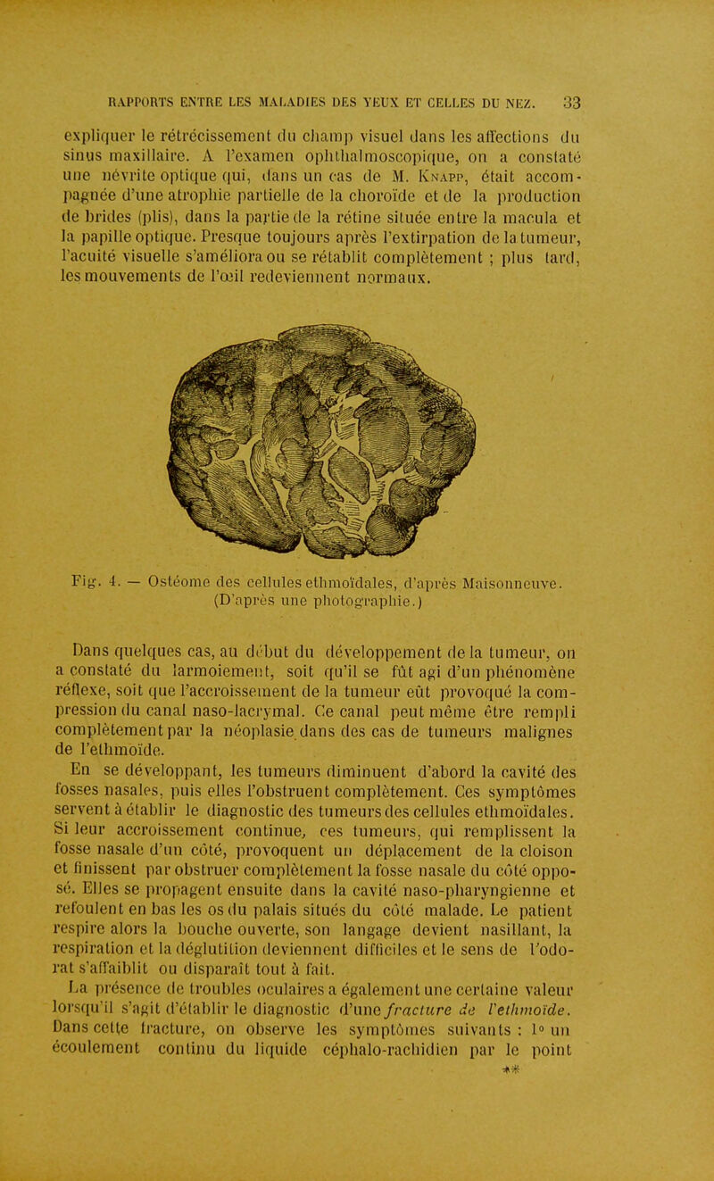 expliquer le rétrécissement du cliamp visuel dans les affections du sinus maxillaire. A l'examen opliilialmoscopique, on a constaté une névrite optique qui, dans un cas de M. Knapp, était accom- pagnée d'une atrophie partielle de la choroïde et de la production de brides (plis), dans la partie de la rétine située entre la macula et la papille optique. Presque toujours après l'extirpation delatumeur, l'acuité visuelle s'améliora ou se rétablit complètement ; plus tard, les mouvements de l'œil redeviennent normaux. Fig. 4. — Ostéome des cellulesethmoïdales, d'après Maisonnciive. (D'api-ès une photograpliie.) Dans quelques cas, au di'but du développement delà tumeur, on a constaté du larmoiement, soit qu'il se fût agi d'un phénomène réflexe, soit que l'accroissement de la tumeur eût provoqué la com- pression du canal naso-lacrymal. Ce canal peut même être rempli complètement par la néoplasie dans des cas de tumeurs malignes de l'ethmoïde. En se développant, les tumeurs diminuent d'abord la cavité des fosses nasales, puis elles l'obstruent complètement. Ces symptômes servent à établir le diagnostic des tumeurs des cellules ethmoïdales. Si leur accroissement continue, ces tumeurs, qui remplissent la fosse nasale d'un côté, provoquent un déplacement de la cloison et finissent par obstruer complètement la fosse nasale du côté oppo- sé. Elles se propagent ensuite dans la cavité naso-pharyngienne et refoulent en bas les os du palais situés du côté malade. Le patient respire alors la bouche ouverte, son langage devient nasillant, la respiration et la déglutition deviennent difficiles et le sens de l'odo- rat s'affaiblit ou disparaît tout à fait. La présence de troubles oculaires a également une certaine valeur lorsqu'il s'agit d'établir le diagnostic d'une fracture de Veihmoïde. Dans cette tracture, on observe les symptômes suivants: 1» un écoulement conlijm du liquide céphalo-rachidien par le point *%