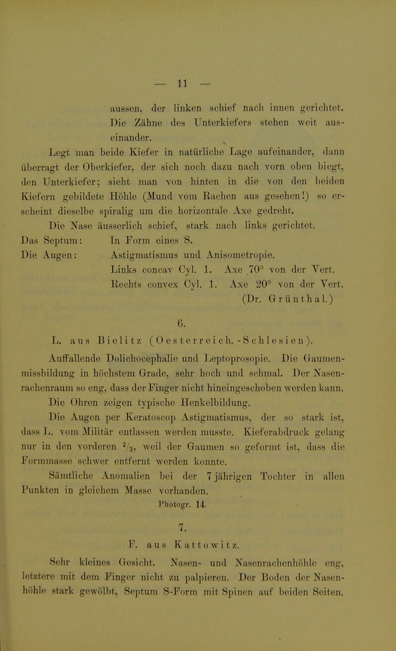 aussen, der linken schief nach innen gerichtet. Die Zähne des Unterkiefers stehen weit aus- einander. Legt man beide Kiefer in natürliche Lage aufeinander, dann überragt der Oberkiefer, der sich. noch, dazu nach vorn oben biegt, den Unterkiefer; sieht man von hinten in die von den beiden Kiefern gebildete Höhle (Mund vom Eachen aus gesehen!) so er- scheint dieselbe spiralig um die horizontale Axe gedreht. Die Nase äusserlich schief, stark nach links gerichtet. Das Septum: In Form eines S. Die Augen: Astigmatismus und Anisometropie. Links concav Cyl. 1. Axe 70° von der Vert. Rechts convex Cyl. 1. Axe 20° von der Vert. (Dr. Grünthal.) 6. L. aus Bielitz (Oesterreich.-Schlesien). Auffallende Dolichocephalie und Leptoprosopie. Die Gaumen- missbildung in höchstem Grade, sehr hoch und schmal. Der Nasen- rachenraum so eng, dass der Finger nicht hineingeschoben werden kann. Die Ohren zeigen typische Henkelbildung. Die Augen per Keratoscop Astigmatismus, der so stark ist, dass L. vom Militär entlassen werden musste. Kieferabdruck gelang nur in den vorderen 2/3, weil der Gaumen so geformt ist, dass die Formmasse schwer entfernt werden konnte. Sämtliche Anomalien bei der 7jährigen Tochter in allen Punkten in gleichem Masse vorhanden. l'hotogr. 14. 7. F. a u s K a t t o w i t z, Sehr kleines Gesicht. Nasen- und Nasenrachen höhle eng, letztere mit dem Finger nicht zu palpieren. Der Boden der Nasen- höhle stark gewölbt, Septum S-Form mit Spinen auf beiden Seiten.