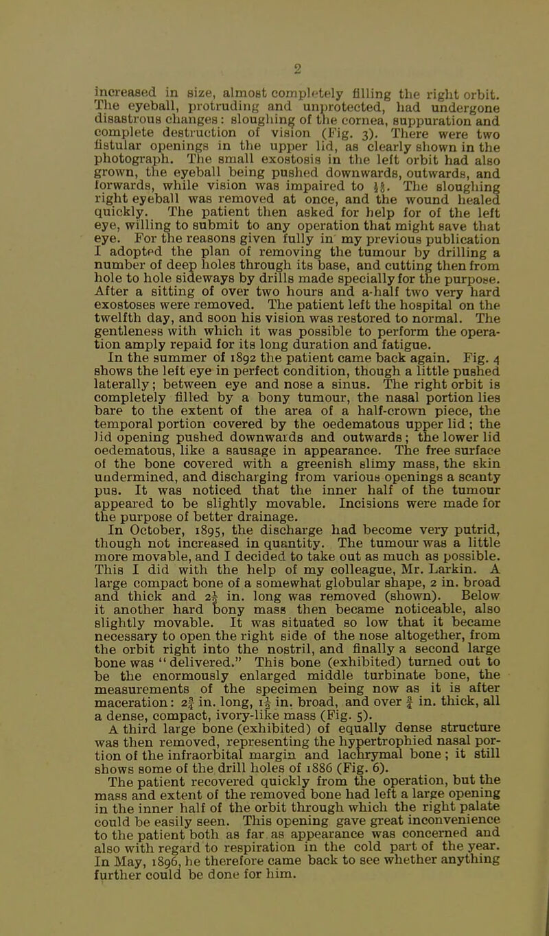2 increased in size, almost completely filling the right orbit. The eyeball, protruding and unprotected, had undergone disastrous changes: sloughing of the cornea, suppuration and complete destruction of vision (Fig. 3). There were two fistular openings in the upper lid, as clearly shown in the photograph. The small exostosis in the left orbit had also grown, the eyeball being pushed downwards, outwards, and forwards, while vision was impaired to U. The sloughing right eyeball was removed at once, and the wound healed quickly. The patient then asked for help for of the left eye, willing to submit to any operation that might save that eye. For the reasons given fully in my previous publication I adopted the plan of removing the tumour by drilling a number of deep holes through its base, and cutting then from hole to hole sideways by drills made specially for the purpose. After a sitting of over two hours and a-half two very hard exostoses were removed. The patient left the hospital on the twelfth day, and soon his vision was restored to normal. The gentleness with which it was possible to perform the opera- tion amply repaid for its long duration and fatigue. In the summer of 1892 the patient came back again. Fig. 4 shows the left eye in perfect condition, though a little pushed laterally; between eye and nose a sinus. The right orbit is completely filled by a bony tumour, the nasal portion lies bare to the extent of the area of a half-crown piece, the temporal portion covered by the oedematous upper lid; the lid opening pushed downwards and outwards; the lower lid oedematous, like a sausage in appearance. The free surface of the bone covered with a greenish slimy mass, the skin undermined, and discharging from various openings a scanty pus. It was noticed that the inner half of the tumour appeared to be slightly movable. Incisions were made for the purpose of better drainage. In October, 1895, the discharge had become very putrid, though not increased in quantity. The tumour was a little more movable, and I decided to take out as much as possible. This I did with the help of my colleague, Mr. Larkin. A large compact bone of a somewhat globular shape, 2 in. broad and thick and 2| in. long was removed (shown). Below it another hard bony mass then became noticeable, also slightly movable. It was situated so low that it became necessary to open the right side of the nose altogether, from the orbit right into the nostril, and finally a second large bone was delivered. This bone (exhibited) turned out to be the enormously enlarged middle turbinate bone, the measurements of the specimen being now as it is after maceration: 2% in. long, \\ in. broad, and over \ in. thick, all a dense, compact, ivory-like mass (Fig. 5). A third large bone (exhibited) of equally dense structure was then removed, representing the hypertrophied nasal por- tion of the infraorbital margin and lachrymal bone; it still shows some of the drill holes of 1886 (Fig. 6). The patient recovered quickly from the operation, but the mass and extent of the removed bone had left a large opening in the inner half of the orbit through which the right palate could be easily seen. This opening gave great inconvenience to the patient both as far as appearance was concerned and also with regard to respiration in the cold part of the year. In May, 1896, he therefore came back to see whether anything further could be done for him.