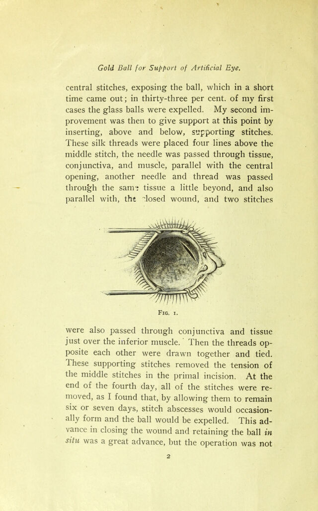 digitised image 2