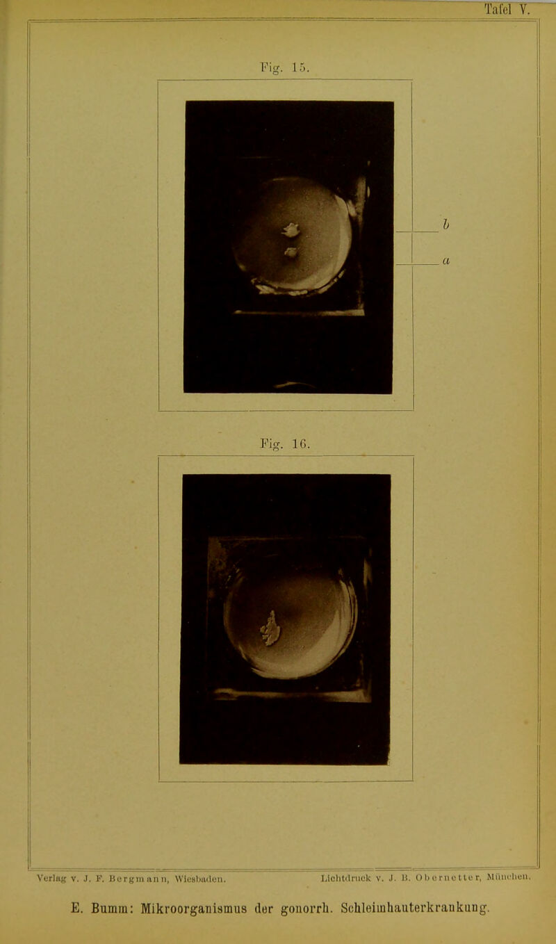 Tafel V. Fig. 15. Verlag v. J. F. Bergmann, Wiesbaden. Lichtdruck v. J. B. Obernetter, München, E. Bumra: Mikroorganismus der gonorrk. Schleiinhauterkraukung.