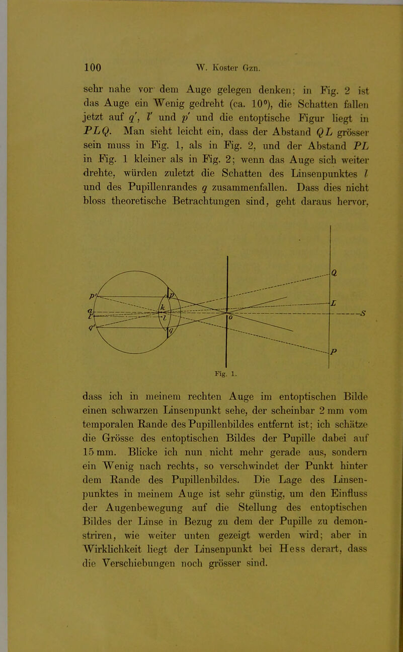 sehr nahe vor' dem Auge gelegen denken; in Fig. 2 ist das Auge ein Wenig gedreht (ca. 10°), die Schatten fallen jetzt auf q, V und p und die entoptische Figur liegt in PLQ. Man sieht leicht ein, dass der Abstand QL grösser sein muss in Fig. 1, als in Fig. 2, und der Abstand PL in Fig. 1 kleiner als in Fig. 2; wenn das Auge sich weiter drehte, würden zuletzt die Schatten des Linsenpunktes l und des Pupillenrandes q zusammenfallen. Dass dies nicht bloss theoretische Betrachtungen sind, geht daraus hervor, Fig. 1. dass ich in meinem rechten Auge im entoptischen Bilde einen schwarzen Linsenpunkt sehe, der scheinbar 2 mm vom temporalen Rande des Pupillenbildes entfernt ist; ich schätze die Grösse des entoptischen Bildes der Pupille dabei auf 15 mm. Blicke ich nun nicht mehr gerade aus, sondern ein Wenig nach rechts, so verschwindet der Punkt hinter dem Bande des Pupillenbildes. Die Lage des Linsen- punktes in meinem Auge ist sehr günstig, um den Einfluss der Augenbewegung auf die Stellung des entoptischen Bildes der Linse in Bezug zu dem der Pupille zu demon- striren, wie weiter unten gezeigt werden wird; aber in Wirklichkeit liegt der Linsenpunkt bei Hess derart, dass die Verschiebungen noch grösser sind.