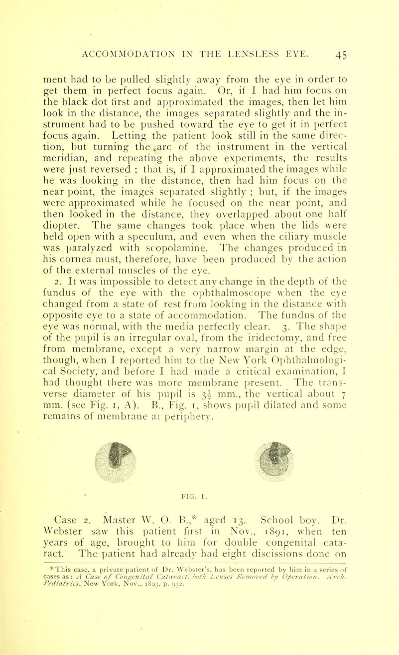 ment had to be pulled slightly away from the eye in order to get them in perfect focus again. Or, if I had him focus on the black dot first and approximated the images, then let him look in the distance, the images separated slightly and the in- strument had to be pushed toward the eye to get it in perfect focus again. Letting the patient look still in the same direc- tion, but turning the .arc of the instrument in the vertical meridian, and repeating the above experiments, the results were just reversed ; that is, if I approximated the images while he was looking in the distance, then had him focus on the near point, the images separated slightly ; but, if the images were approximated while he focused on the near point, and then looked in the distance, they overlapped about one half diopter. The same changes took place when the lids were held open with a speculum, and even when the ciliary muscle was paralyzed with scopolamine. The changes produced in his cornea must, therefore, have been produced by the action of the external muscles of the eye. 2. It was impossible to detect any change in the depth of the fundus of the eye with the ophthalmoscope when the eye changed from a state of rest from looking in the distance with opposite eye to a state of accommodation. The fundus of the eye was normal, with the media perfectly clear. 3. The shape of the pupil is an irregular oval, from the iridectomy, and free from membrane, except a very narrow margin at the edge, though, when I reported him to the New York Ophthalmologi- cal Society, and before I had made a critical examination, I had thought there was more membrane present. The trans- verse diameter of his pupil is 3^ mm., the vertical about 7 mm. (see Fig. 1, A). B., Fig. t, shows pupil dilated and some remains of membrane at periphery. FIG. t Case 2. Master W. O. B.,* aged 13. School boy. Dr. Webster saw this patient first in Nov., 1891, when ten years of age, brought to him for double congenital cata- ract. The patient had already had eight discissions done on *This case, a private patient of Dr. Webster's, has been reported by him in a series of cases as: A Case of Congenital Cataract, both Lenses Removed by Operation. Arch. Pediatrics, New York, Nov., 1893, p. 932.