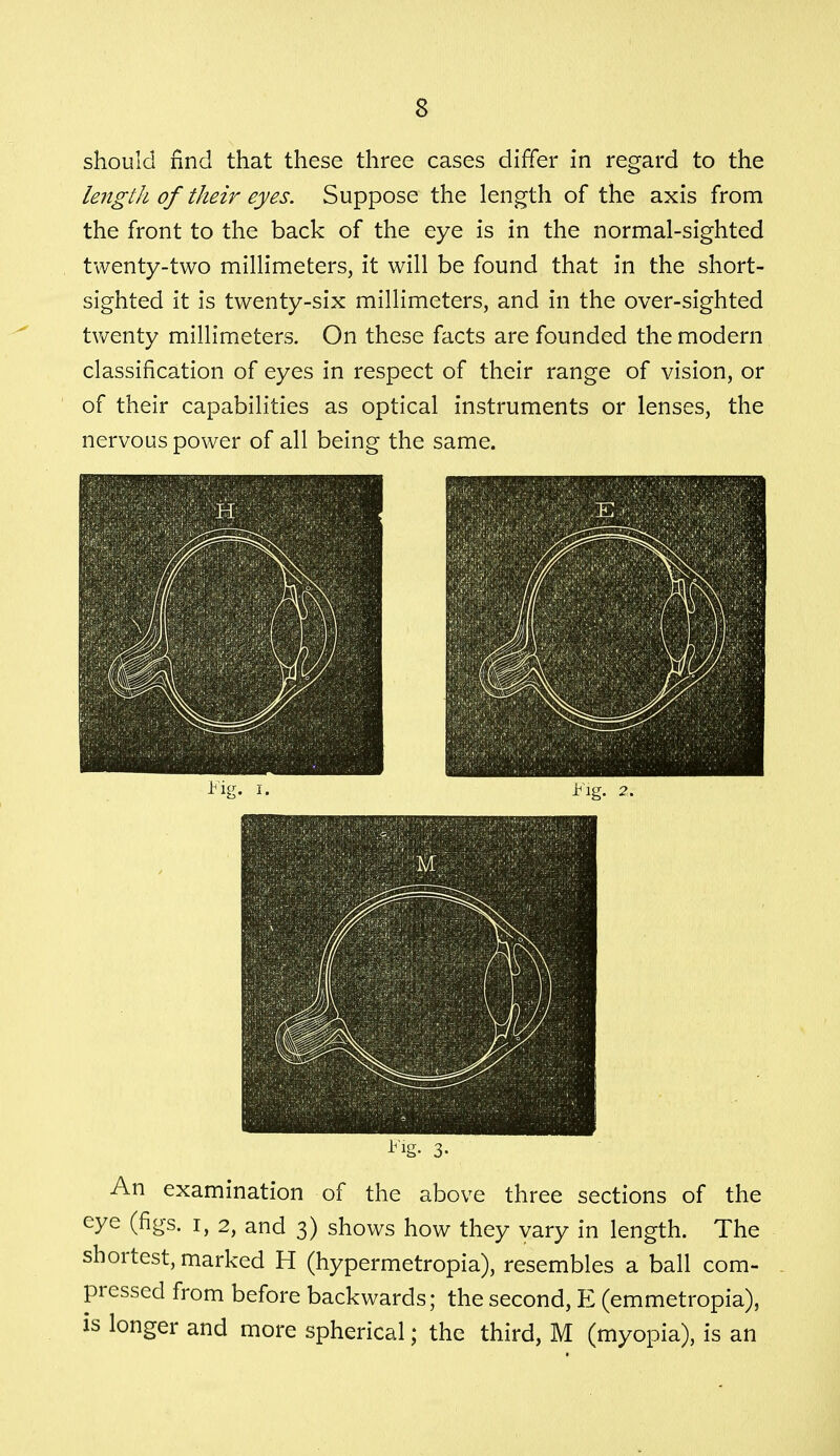 should find that these three cases differ in regard to the length of their eyes. Suppose the length of the axis from the front to the back of the eye is in the normal-sighted twenty-two millimeters, it will be found that in the short- sighted it is twenty-six millimeters, and in the over-sighted twenty millimeters. On these facts are founded the modern classification of eyes in respect of their range of vision, or of their capabilities as optical instruments or lenses, the nervous power of all being the same. An examination of the above three sections of the eye (figs, i, 2, and 3) shows how they vary in length. The shortest, marked H (hypermetropia), resembles a ball com- pressed from before backwards; the second, E (emmetropia), is longer and more spherical; the third, M (myopia), is an