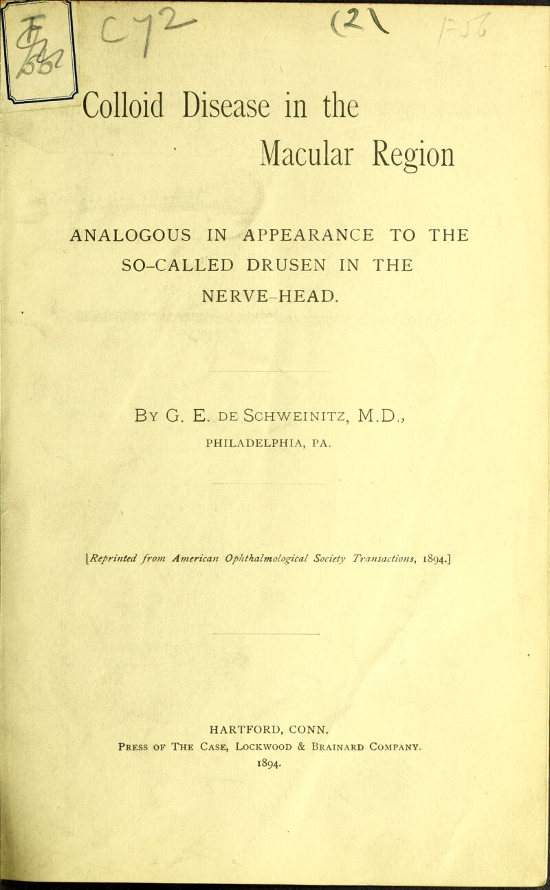 t*V /-j Colloid Disease in the Macular Region ANALOGOUS IN APPEARANCE TO THE SO-CALLED DRUSEN IN THE NERVE-HEAD. By G. E. de Schweinitz, M.D., PHILADELPHIA, PA. \Reprinted from American Oplithalmological Society Transactions, 1894.] HARTFORD, CONN. Press of The Case, Lockwood & Brainard Company. 1894.