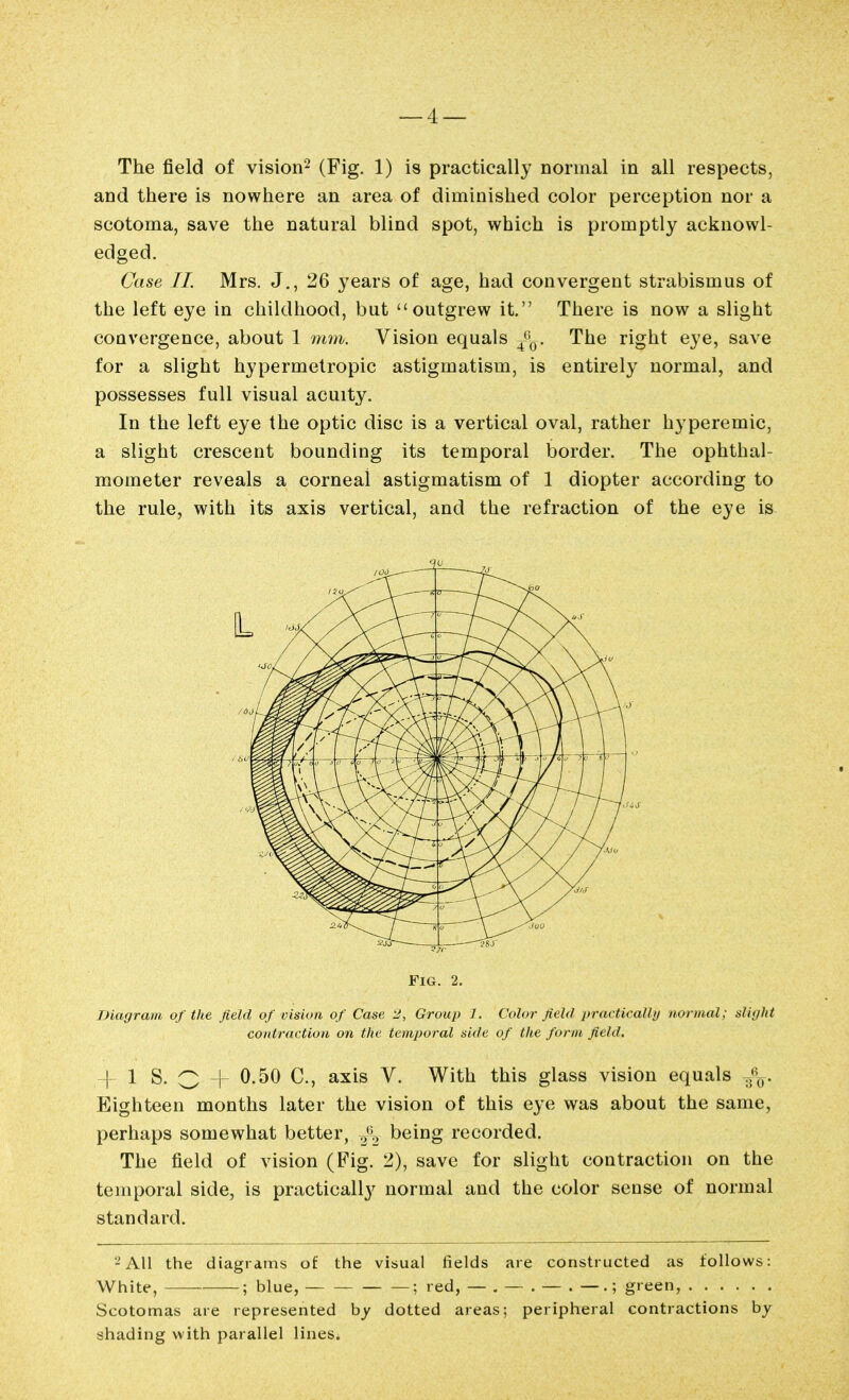 The field of vision- (Fig. 1) is practically normal in all respects, and there is nowhere an area of diminished color perception nor a scotoma, save the natural blind spot, which is promptly acknowl- edged. Case II. Mrs. J., 26 years of age, had convergent strabismus of the left eye in childhood, but outgrew it. There is now a slight convergence, about 1 mm. Vision equals ^^^q. The right eye, save for a slight hypermetropic astigmatism, is entirely normal, and possesses full visual acuity. In the left eye the optic disc is a vertical oval, rather hyperemic, a slight crescent bounding its temporal border. The ophthal- mometer reveals a corneal astigmatism of 1 diopter according to the rule, with its axis vertical, and the refraction of the eye is Fig. 2. Diagram of the field of vision of Case 2, Group 1. Color field practicaUij iioniial; alii/ht contraction on the temporal side of the form field. -|- 1 S. O -f 0.50 C, axis V. With this glass vision equals .f^. Eighteen months later the vision of this eye was about the same, perhaps somewhat better, being recorded. The field of vision (B'ig. 2), save for slight contraction on the temporal side, is practically normal and the color sense of normal standard. -AH the diagrams of the visual fields are constructed as follows: White, —— ; blue, ; red, — . — . — • — .; green, Scotomas are represented hy dotted areas; peripheral contractions by shading with parallel lines.