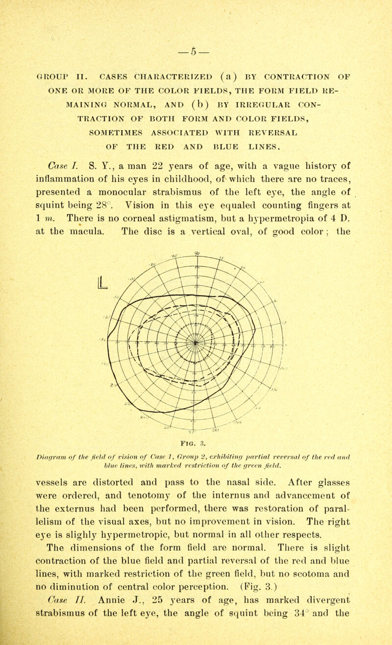 — 5- GROUP II. CASES CHARACTERIZED (a) BY CONTRACTION OF ONE OR MORE OF THE COLOR FIELDS, THE FORM FIELD RE- MAINING NORMAL, AND (b) BY IRREGULAR CON- TRACTION OF BOTH FORM AND COLOR FIELDS, SOMETIMES ASSOCIATED WITH REVERSAL OF THE RED AND BLUE LINES. Case I. S. Y., a man 22 years of age, with a vague history of inflammation of his eyes in childhood, of which there are no traces, presented a monocular strabismus of the left eye, the angle of squint being 28Vision in this eye equaled counting fingers at 1 m. There is no corneal astigmatism, but a hypermetropia of 4 D. at the macula. The disc is a vertical oval, of good color ; the Diagram of the field of vision of Case J, Groiqy 2, exhibitinf/ partial reversal of the red and vessels are distorted and pass to the nasal side. After glasses were ordered, and tenotomy of the internus and advancement of the externus had been performed, there was restoration of paral- lelism of the visual axes, but no improvement in vision. The right eye is slighly hypermetropic, but normal in all other respects. The dimensions of the form field are normal. There is slight contraction of the blue field and partial reversal of the red and blue lines, with marked restriction of the green field, but no scotoma and no diminution of central color perception. (Fig. 3.) Case IJ. Annie J., 25 years of age, has marked divergent strabismus of the left eye, the angle of squint being and the Fig. 3. hhie lines, ivith marled restriction of the green field.