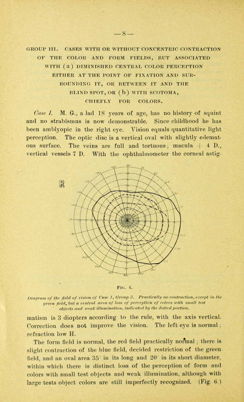 GROUP III. CASES WITH OR WITHOUT CONCENTRIC CONTRACTION OF THE COLOR AND FORM FIELDS, BUT ASSOCIATED WITH (a) DIMINISHED CENTRAL COLOR PERCEPTION EITHER AT THE POINT OF FIXATION AND SUR- ROUNDING IT, OR BETWEEN IT AND THE BLIND SPOT, OR (b) AVITH SCOTOMA, CHIEFLY FOR COLORS. Case I. M. G., a lad 18 years of age, has no history of squint and no strabismus is now demonstrable. Since childhood he has been amblyopic in the right eye. Vision equals quantitative light perception. The optic disc is a vertical oval with slightly edemat- ous surface. The veins are full and tortuous; macula -f^ 4 D., vertical vessels 7 D. With the ophthalmometer the corneal astig- 1 Fig. 6. Diagram of the field of vision of Case 7, Grovp .9. PracficaiJif vo contraction, except in the green field, hut a central area of h>i<!< of perception of colors with small test objects and veal: illnminatioii, indicated hi/ the dotU d portion. matism is 3 diopters according to the rule, with the axis vertical. Correction does not improve the vision. The left eye is normal; refraction low H. The form field is normal, the red field practically normal ; there is slight contraction of the blue field, decided restriction of the green field, and an oval area 35 in its long and 20 in its short diameter, within which there is distinct loss of the perception of form and colors with small test objects and weak illumination, although with large tests object colors are still imperfectly recognized. (Fig. 6.)