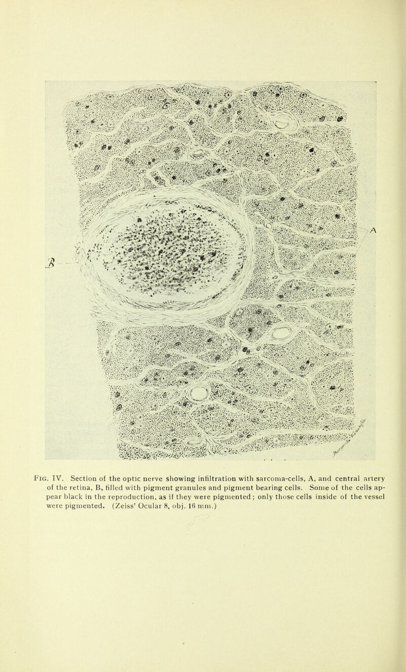 of the retina, B, filled with pigment granules and pigment bearing cells. Some of the cells ap- pear black in the reproduction, as if they were pigmented ; only those cells inside of the vessel were pigmented. (Zeiss' Ocular 8, obj. 16 mm.)