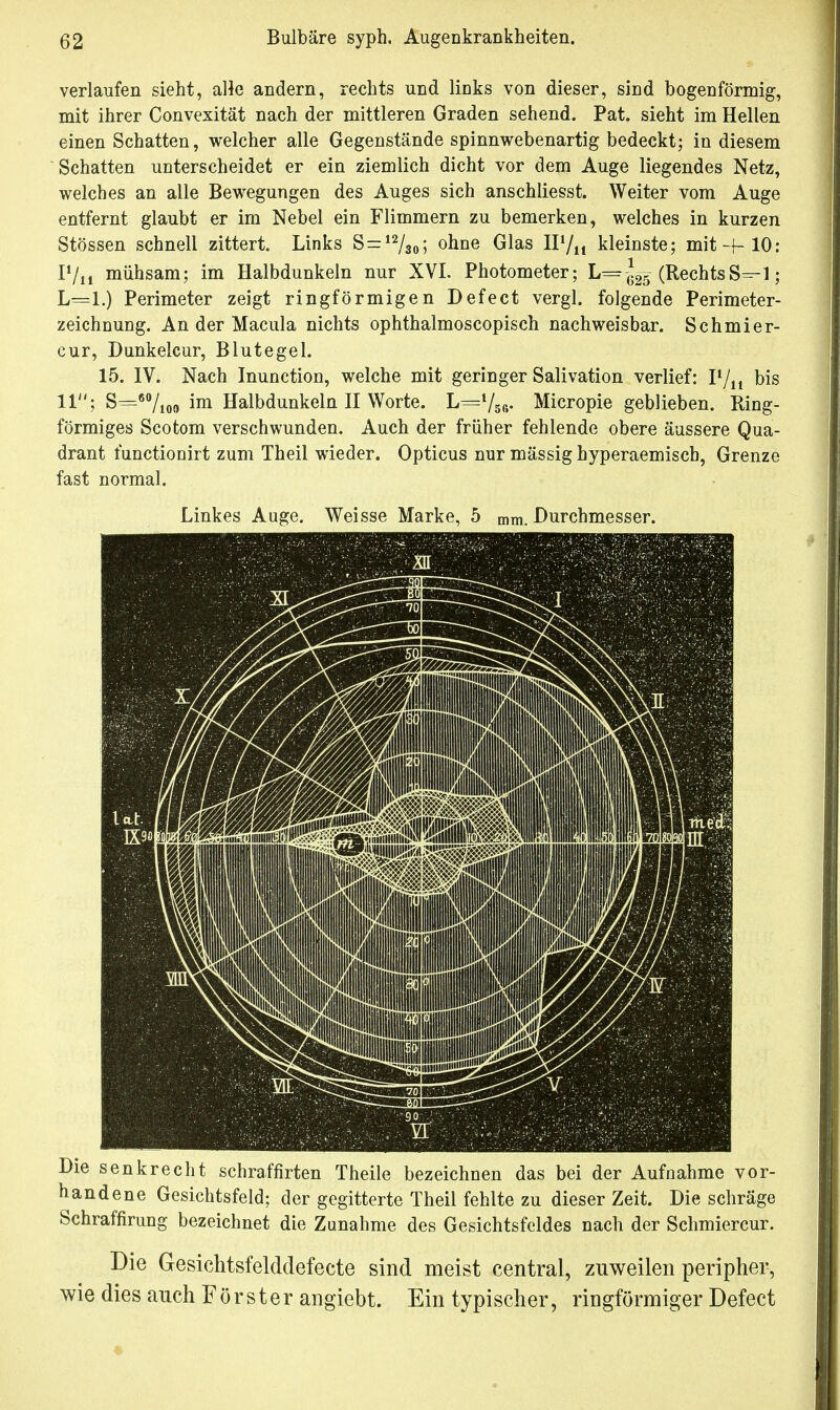 verlaufen sieht, alle andern, rechts und links von dieser, sind bogenförmig, mit ihrer Convexität nach der mittleren Graden sehend. Pat. sieht im Hellen einen Schatten, welcher alle Gegenstände spinnwebenartig bedeckt; in diesem Schatten unterscheidet er ein ziemlich dicht vor dem Auge liegendes Netz, welches an alle Bewegungen des Auges sich anschliesst. Weiter vom Auge entfernt glaubt er im Nebel ein Flimmern zu bemerken, welches in kurzen Stössen schnell zittert. Links S = 12/30; °hne Glas II7lt kleinste; mit-f-10: P/n mühsam; im Halbdunkeln nur XVI. Photometer; L=-J2-5- (RechtsS=-1; L=l.) Perimeter zeigt ringförmigen Defect vergl. folgende Perimeter- zeichnung. An der Macula nichts ophthalmoscopisch nachweisbar. Schmier- cur, Dunkelcur, Blutegel. 15. IV. Nach Inunction, welche mit geringer Salivation verlief: P/n bis 11; S=60/ 10!) im Halbdunkeln II Worte. L=l/se' Micropie geblieben. Ring- förmiges Scotom verschwunden. Auch der früher fehlende obere äussere Qua- drant functionirt zum Theil wieder. Opticus nur mässig hyperaemiscb, Grenze fast normal. Linkes Auge. Weisse Marke, 5 mm. Durchmesser. Die senkrecht schraffirten Theile bezeichnen das bei der Aufnahme vor- handene Gesichtsfeld; der gegitterte Theil fehlte zu dieser Zeit. Die schräge Schraffirung bezeichnet die Zunahme des Gesichtsfeldes nach der Schmiercur. Die Gesichtsfelddefecte sind meist central, zuweilen peripher, wie dies auch Förster angiebt. Ein typischer, ringförmiger Defect