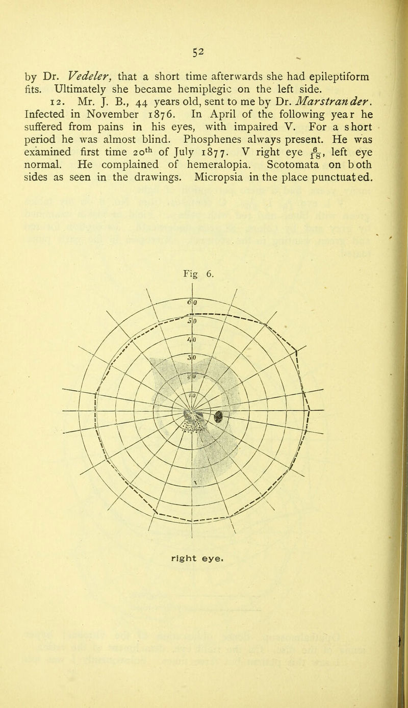 by Dr. Vedeler, that a short time afterwards she had epileptiform fits. Ultimately she became hemiplegic on the left side. 12. Mr. J. B., 44 years old, sent to me by Dr. Marstrander. Infected in November 1876. In April of the following year he suffered from pains in his eyes, with impaired V. For a short period he was almost blind. Phosphenes always present. He was examined first time 20th of July 1877. V right eye r6g, left eye normal. He complained of hemeralopia. Scotomata on both sides as seen in the drawings. Micropsia in the place punctuated. Fig 6. right eye.